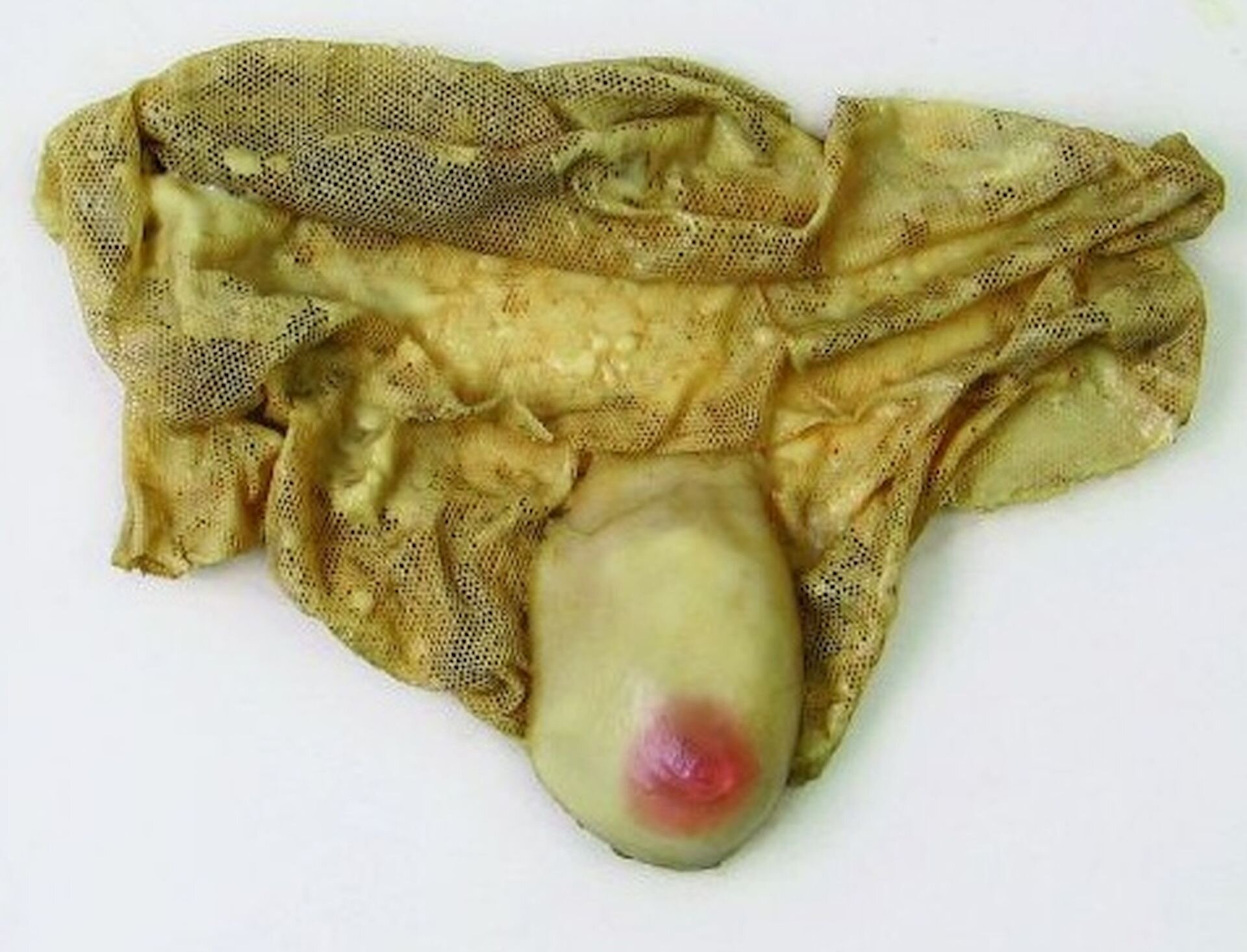 Zdjęcie przedstawia rzeźbę Aliny Szapocznikowej Łza.