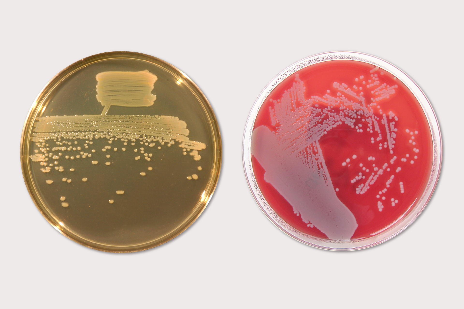 Fotografia przedstawia dwa okrągłe, płaskie, szklane naczynia, zwane szalkami Petriego, wykorzystywane w laboratoriach. Lewa ma kolor brązowy, prawa czerwony. Na obu szalkach znajdują się białe smugi i kropki. Są to kolonie bakterii.