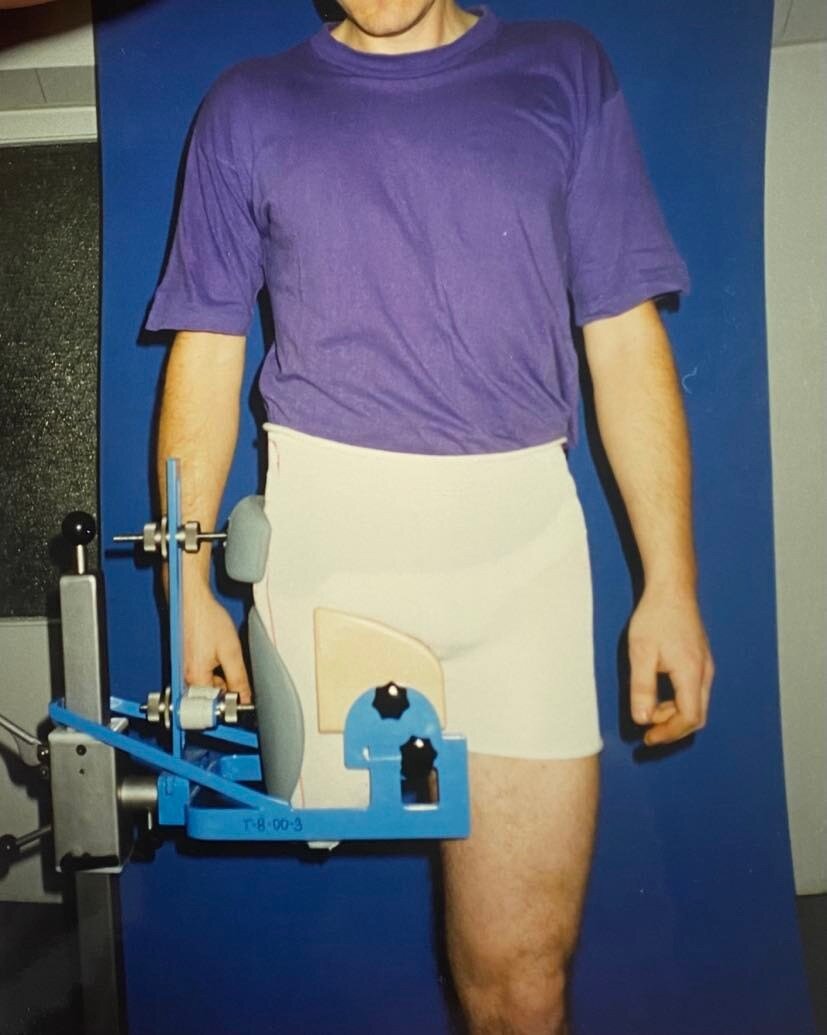 Zdjęcie przedstawia stojącego przodem pacjenta. Jego prawa kończyna została amputowana na wysokości stawu kolanowego. Kikut umieszczony jest w przyrządzie, za pomocą którego dokonuje się pomiarów zewnętrznej części uda, pachwiny i miednicy. 