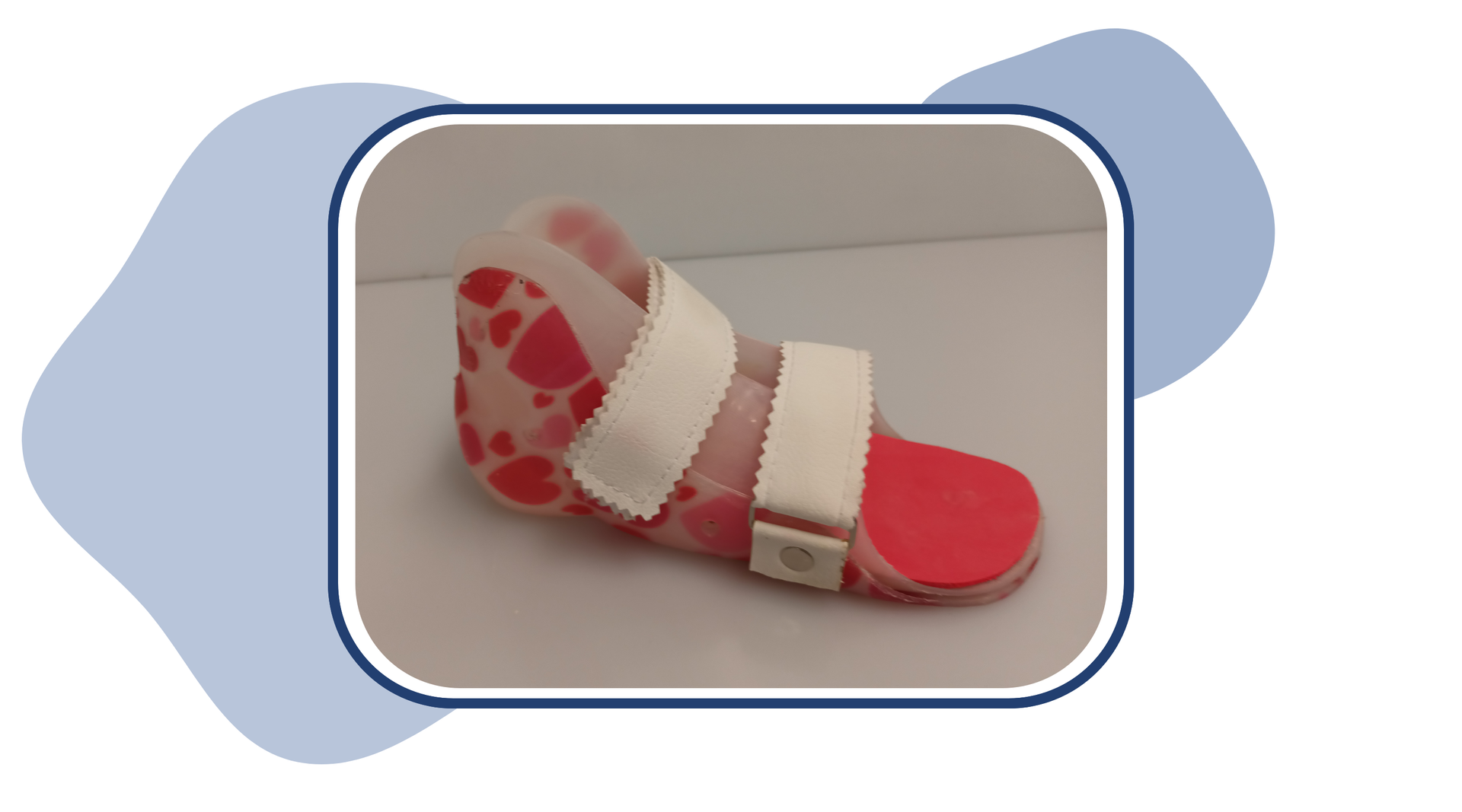 Zdjęcie przedstawia ortezę mającą formę płaskiej podeszwy i przedłużenie wzdłuż ścięgna Achillesa użytkownika. Orteza jest mocowana za pomocą dwóch rzepów: w miejscu kości śródstopia i stawu skokowego pacjenta.
