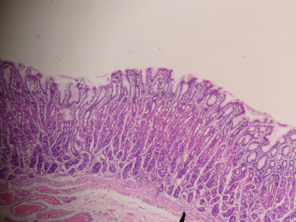 Zdjęcie mikroskopowe przedstawia ścianę żołądka. Obecne są cztery warstwy. Najbardziej wewnętrzna to pofałdowana błona śluzowa zabarwiona na kolor fioletowy,  zbudowana z komórek walcowatych, z cewkowatymi gruczołami powstałymi przez wpuklanie się nabłonka. Pod nią znajduje się zabarwiona na fioletowo łącznotkankowa błona podśluzowa zbudowana z luźno ułożonych komórek z licznymi kanalikowymi przestrzeniami pomiędzy. Niżej znajduje się wybarwiona na różowo błona mięśniowa z komórkami ściśle do siebie przylegającymi, tworzącymi włókna mięśniowe. Pod nimi znajduje się błona surowicza zbudowana z cienkiej warstwy komórek, ściśle przylegająca do błony mięśniowej. 