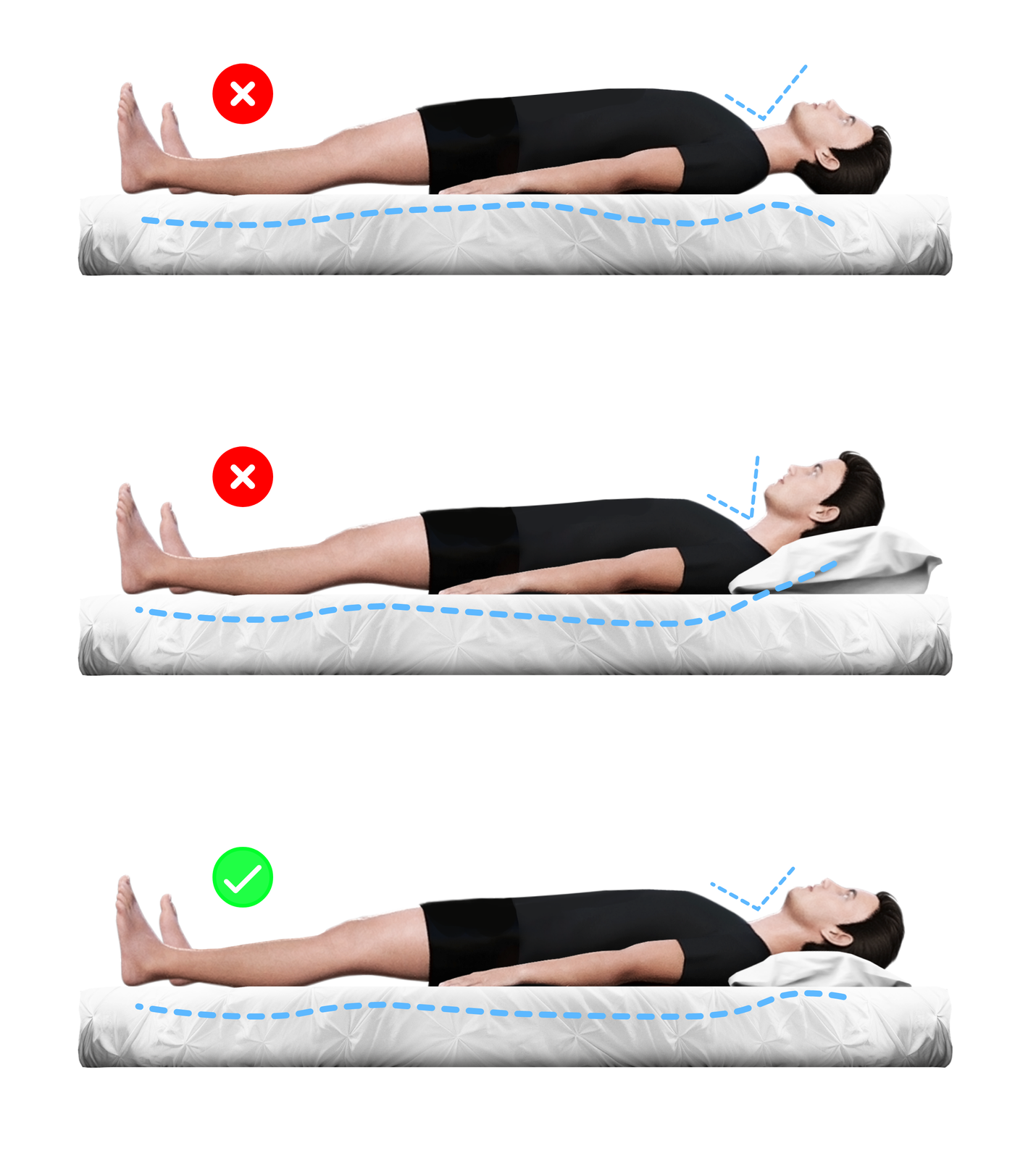 Ilustracja przedstawia trzy sylwetki człowieka leżącego na materacu.  Pierwsza pozycja jest nieprawidłowa. Człowiek leży na materacu bez poduszki położonej pod głową. Kąt między klatką piersiową a głową jest nieprawidłowy.  Druga pozycja jest nieprawidłowa. Człowiek leży na materacu z poduszką położną pod głową. Poduszka jest zbyt wysoka głowa jest zbyt pochylona w kierunku klatki piersiowej. Kąt między klatką piersiową a głową jest nieprawidłowy, zbyt ostry.  Trzecia pozycja jest prawidłowa. Człowiek leży na materacu z poduszką położną pod głową. Poduszka jest idealnie dopasowana do szyi. Podpiera szyję jednocześnie nie podnosząc czubka głowy do góry. Kąt między klatką piersiową a głową jest prawidłowy. 