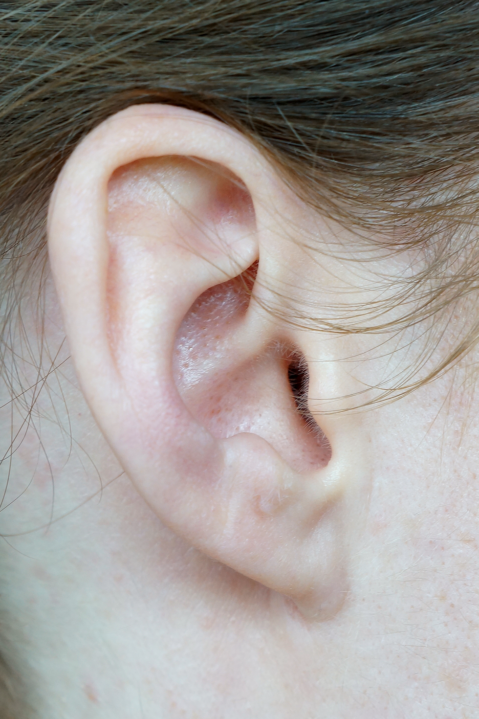 Ilustracja przedstawia zbliżenie ucha ludzkiego w ujęciu z założonymi za nie ciemnymi włosami. Charakterystyczna dla 20-25% Polaków cecha, że dolna część ucha jest bezpośrednio połączona ze skórą twarzy.