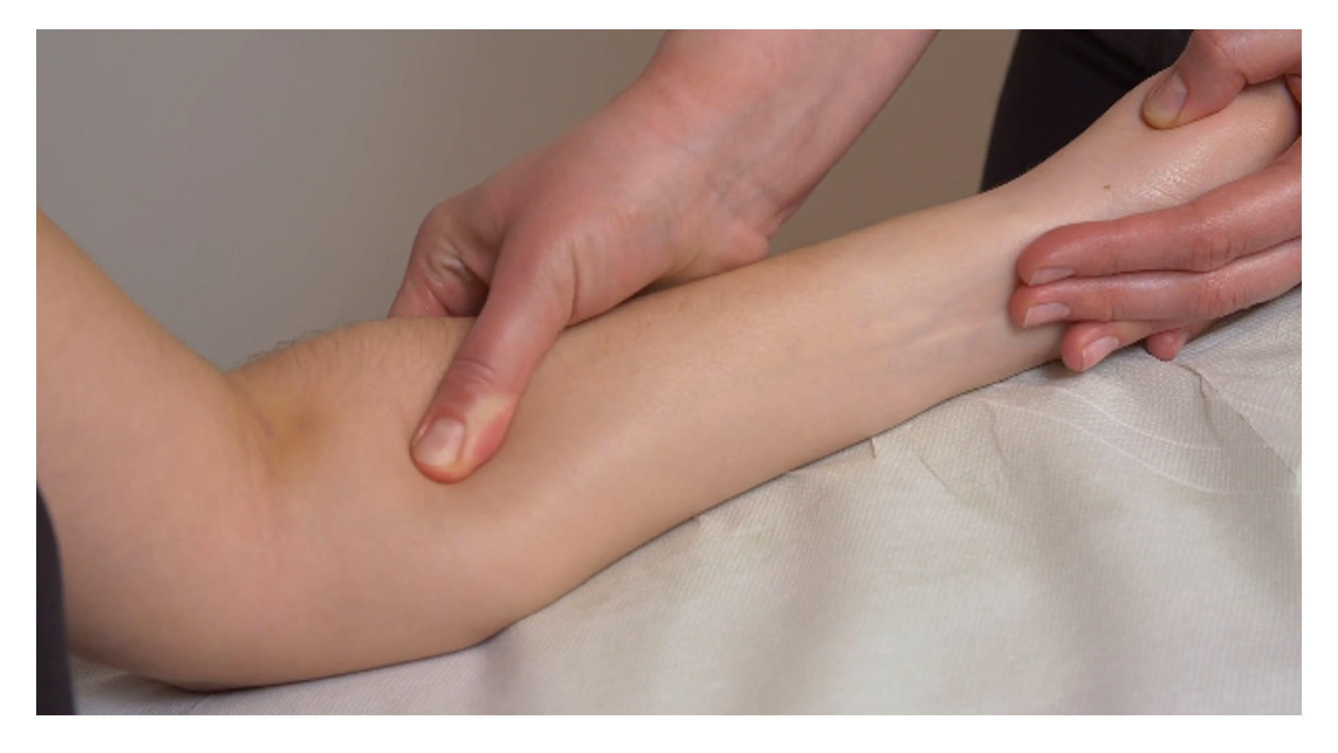 Zdjęcie pod tytułem ugniatanie i uciski mięśni przedramienia. Zdjęcie przedstawia rękę masażysty obejmującą przedramię pacjenta i ugniatającą jego wewnętrzną stronę przy użyciu opuszka kciuka.