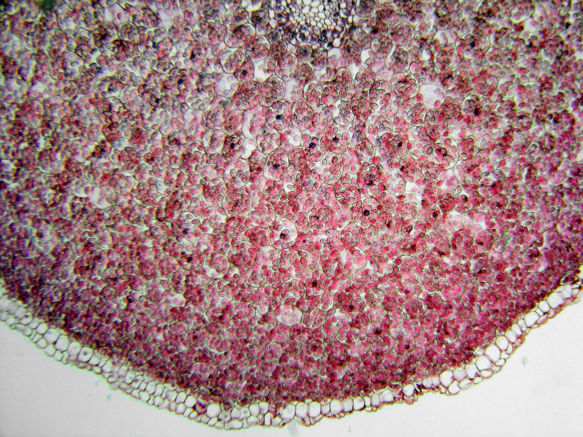 Zdjęcie przedstawia komórki miękiszowe pod mikroskopem. Komórki mają zaokrąglony kształt i jasnoróżową barwę. Znajdują się w dużym skupisku. Usytuowane są blisko siebie, pozostawiając niewielką przestrzeń pomiędzy nimi.