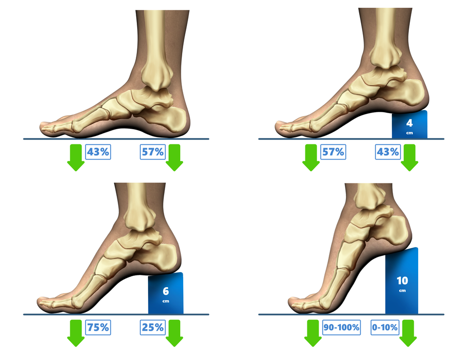 Ilustracja przedstawia obciążenie pierwszej kości śródstopia w butach na niskim i wysokim obcasie. Na pierwszym rysunku stopa umieszczona jest na płaskim podłożu. Oznaczono obciążenie śródstopia na poziomie 43% i pięty na poziomie 57%.  Na drugim rysunku stopa umieszczona jest na płaskim podłożu i 4 centymetrowym obcasie. Oznaczono obciążenie śródstopia na poziomie 57% i pięty na poziomie 43%.  Na trzecim rysunku stopa umieszczona jest na płaskim podłożu i 6 centymetrowym obcasie. Oznaczono obciążenie śródstopia na poziomie 75% i pięty na poziomie 25%.  Na czwartym rysunku stopa umieszczona jest na płaskim podłożu i 10 centymetrowym obcasie. Oznaczono obciążenie śródstopia na poziomie 90‑100% i pięty na poziomie 0‑10%. 