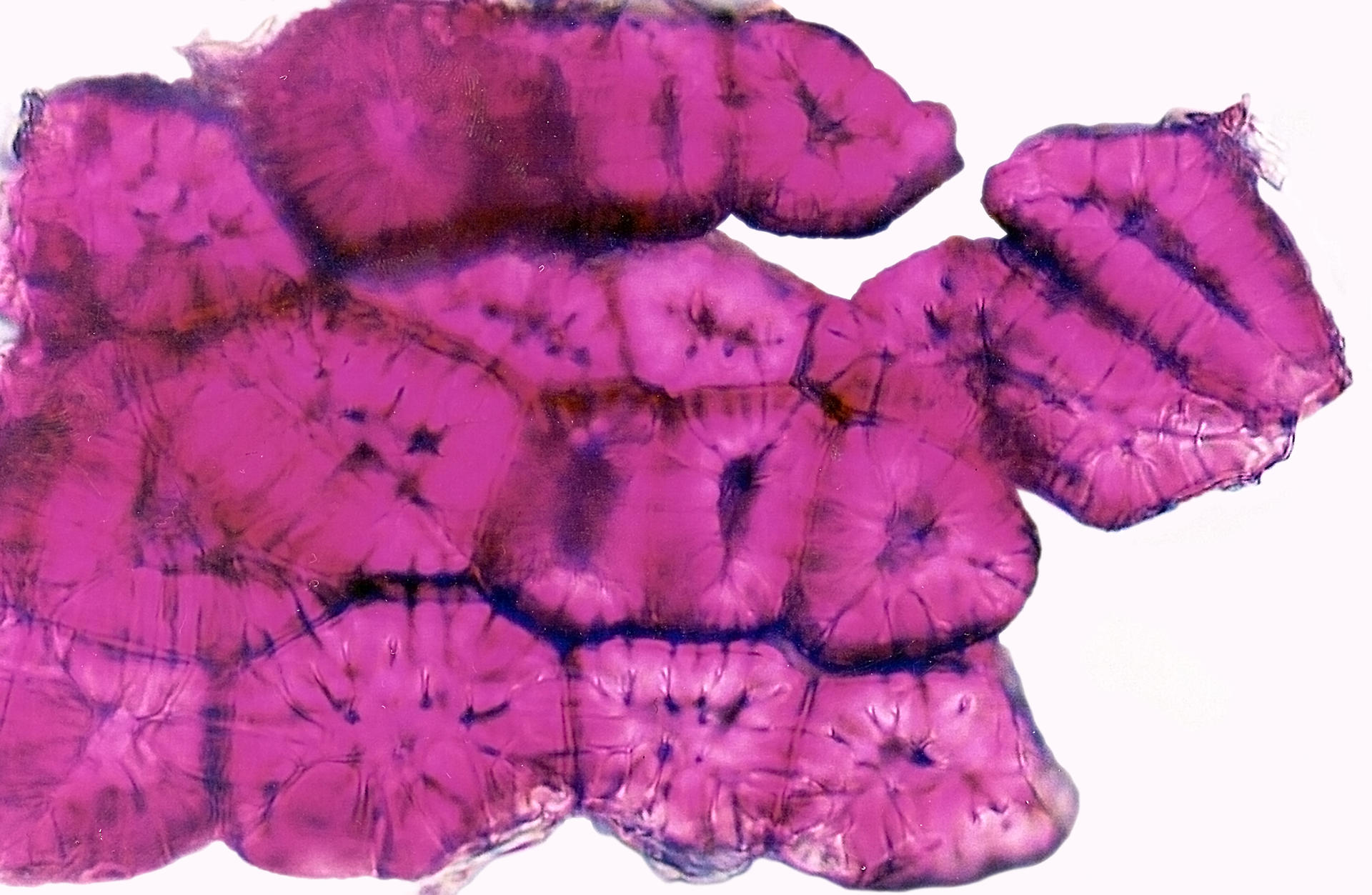 Fotografia mikroskopowa przedstawia powiększenie obrazu komórek kamiennych. Komórki mają b. grube ściany i małe światło. Wybarwione na różowo.