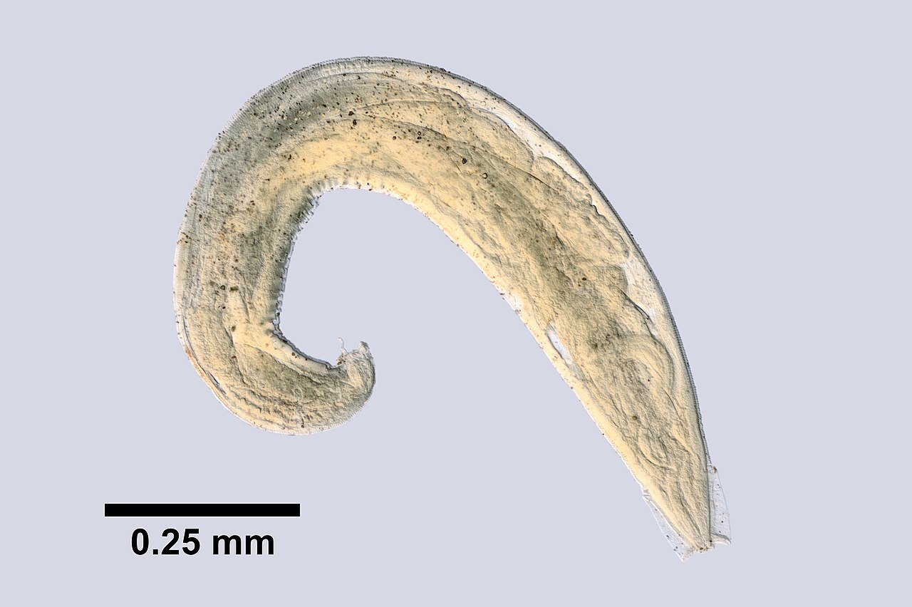 Zdjęcie przedstawia owsika. To jasny robak o wydłużonym ciele. Końce jego ciała zwężają się. Środek ciała jest szeroki.