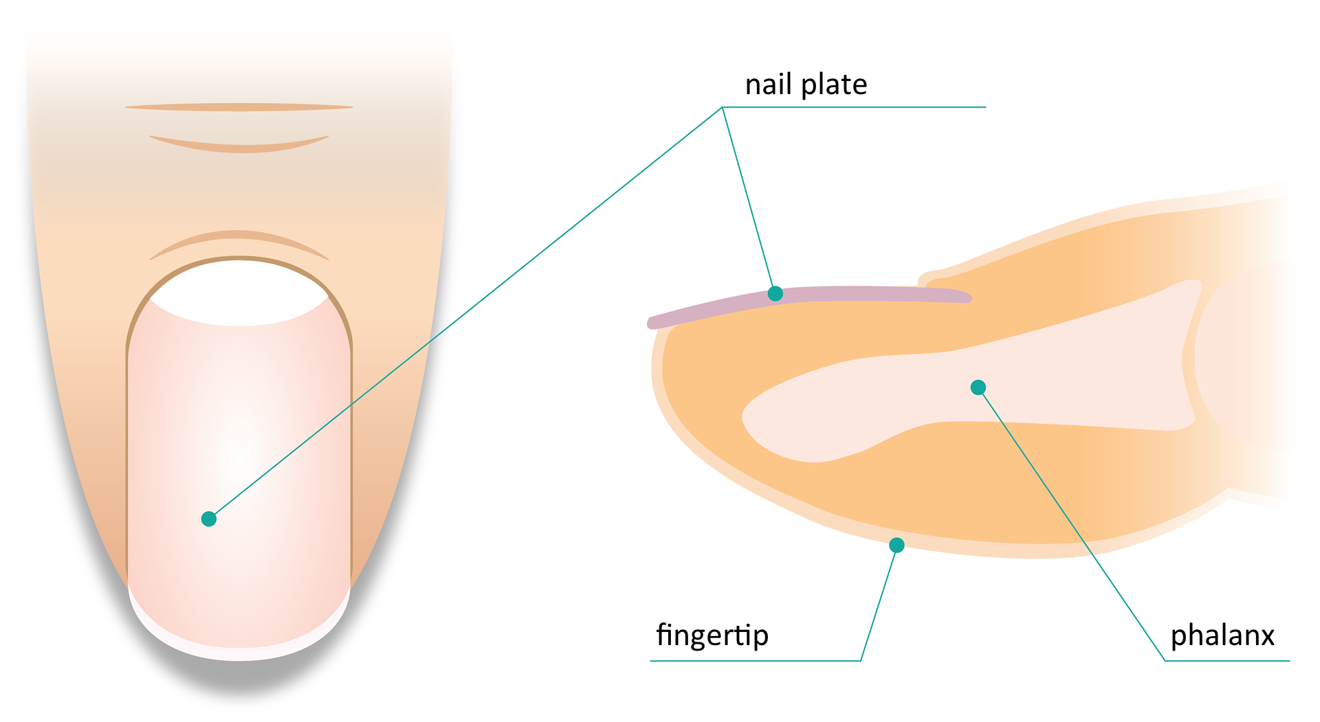 Ilustracja z przedstawia w powiększeniu palec człowieka wraz z paznokciem widziany z góry. Z prawej przekrój poprzeczny przez czubek palca z widoczną płytką paznokcia (nail plate). W pomarańczowym wnętrzu opuszki palca (fingertip) zaznaczono szarą kość paliczka (phalanx). U góry na opuszce liliowo zaznaczono płytkę paznokcia (nail plate). 