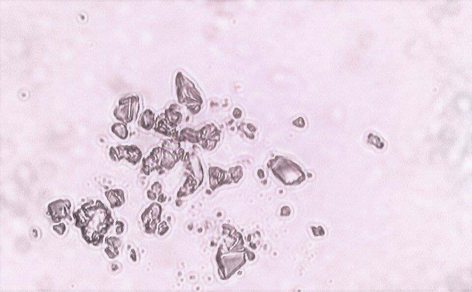 Ilustracja przedstawia zdjęcie mikroskopowe. Wyróżniają się struktury o nieregularnym kształcie. Są położone blisko siebie. Mają różną wielkość. 
