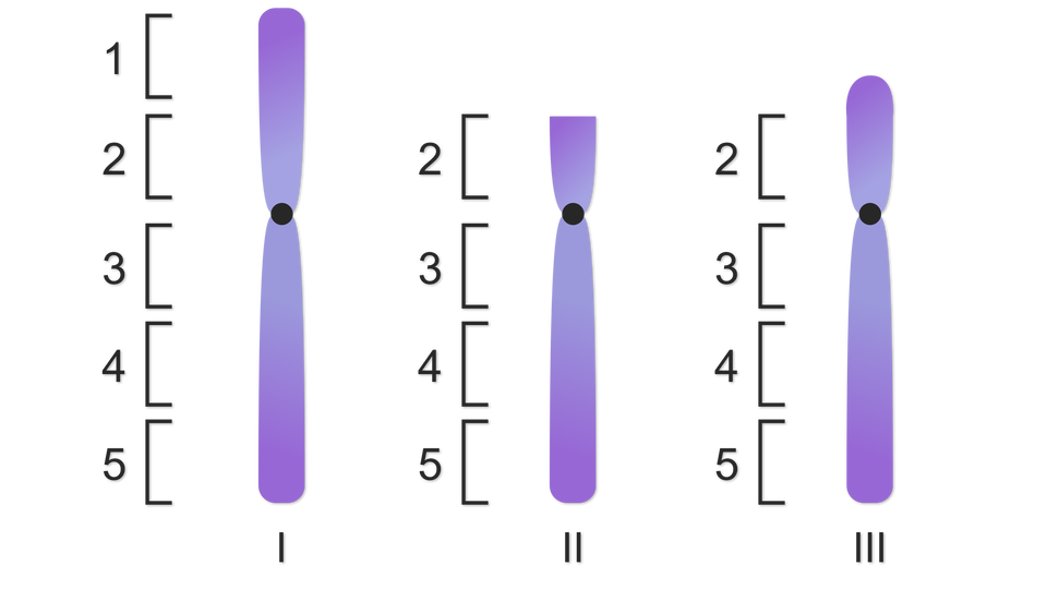 Grafika przedstawia trzy chromosomy. Pierwszy z nich jest prawidłowy, składa się z 5 segmentów. Drugi z nich posiada aberrację – widoczny jest brak całego pierwszego segmentu. Trzeci także posiada aberrację – widoczny jest brak części pierwszego segmentu.