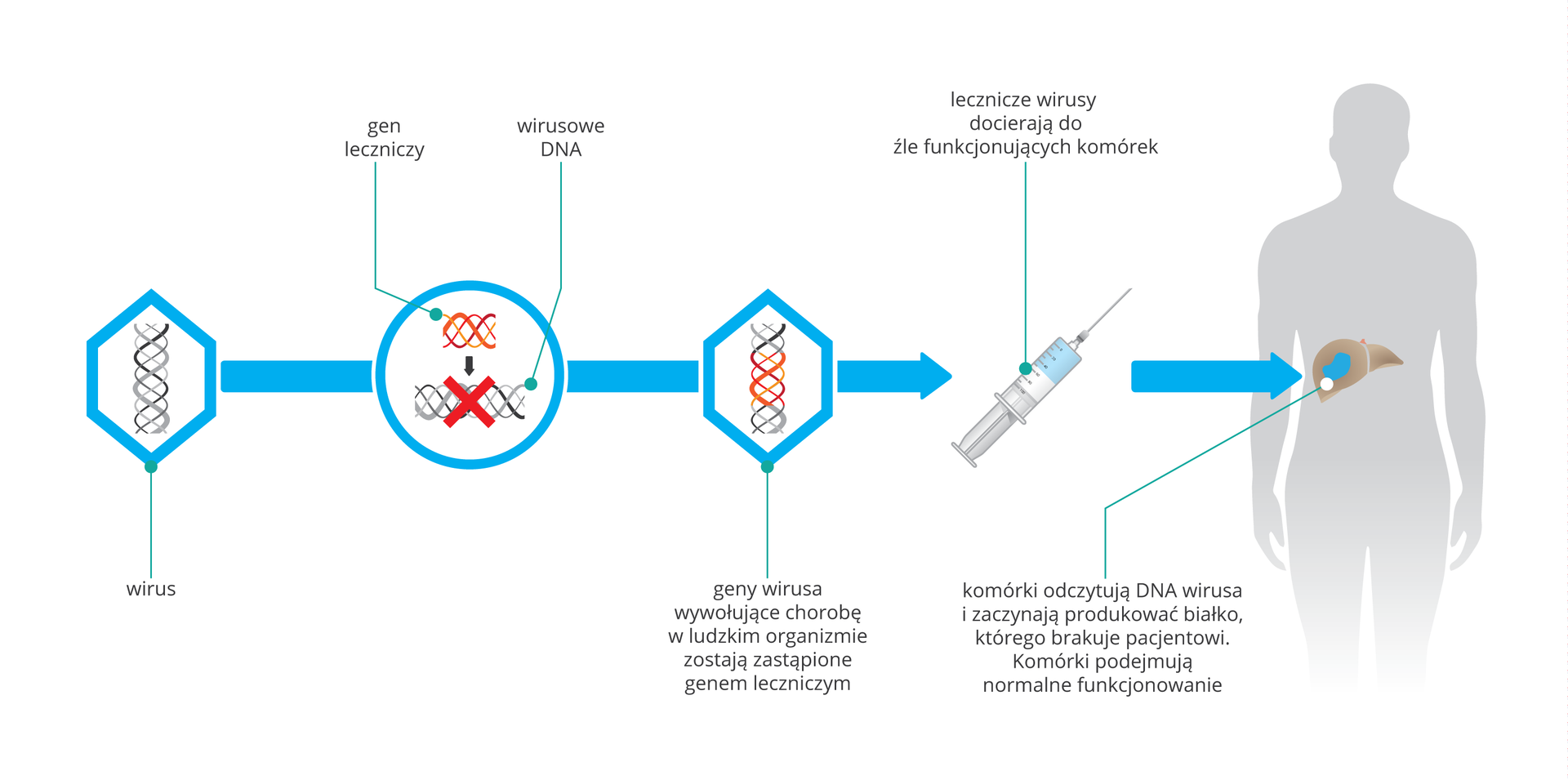 Schematyczna ilustracja terapii genowej. Na pierwszym obrazku wirus z DNA. Na drugim wprowadzenie genu leczniczego do DNA wirusowego. Obrazek 3 przedstawia zmodyfikowane DNA. Podpis: geny wirusa wywołujące chorobę w ludzkim organizmie zostają zastąpione genem leczniczym. Obrazek 4 przedstawia strzykawkę. Podpis: lecznicze wirusy docierają do źle funkcjonujących komórek. Obrazek 5 przedstawia człowieka z widoczną wątrobą. Podpis: komórki odczytują DNA wirusa i zaczynają produkować białko, którego brakuje pacjentowi. Komórki podejmują normalne funkcjonowanie.
