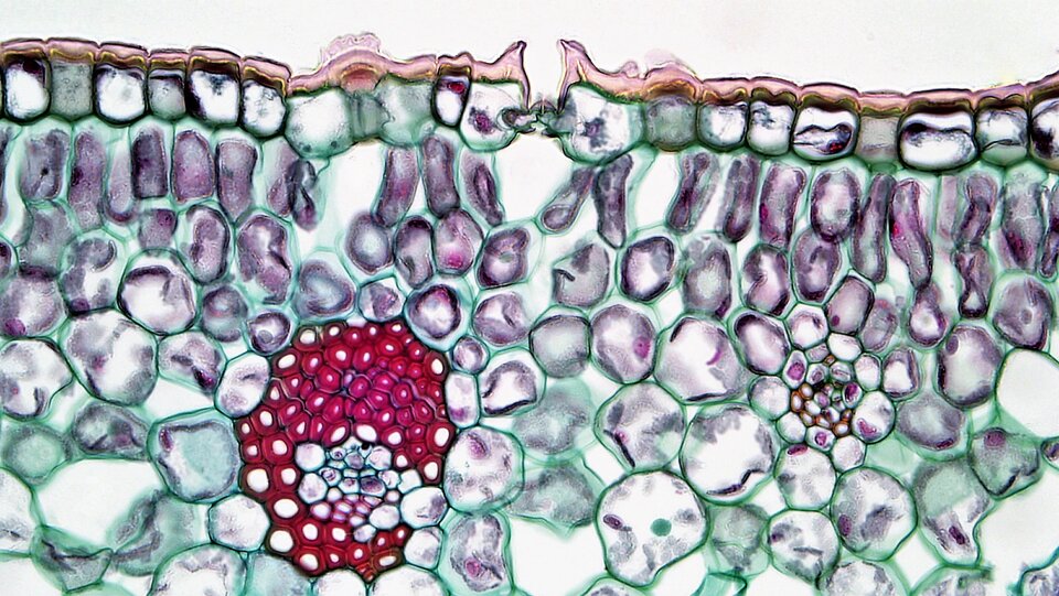 Zdjęcie mikroskopie przedstawia przekrój przez warstwę tkanki asymilacyjnej liścia. Jest ona złożona z wielu owalnych i kulistych komórek położonych obok siebie i wybarwionych na kolor fioletowy. W głębi tkanki asymilacyjnej, pomiędzy komórkami znajdują się w jednym miejscu drobne, kuliste formy skrobi oznaczone kolorem czerwonym. We wnętrzu komórek skrobi znajdują się białe plamki.