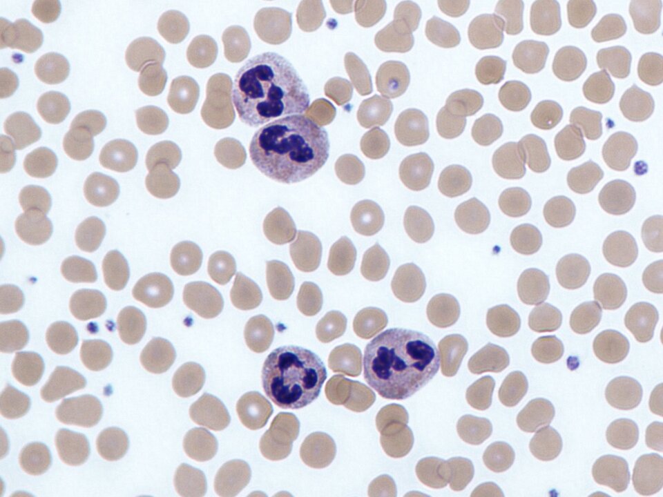 Na fotografii z mikroskopu świetlnego w powiększeniu tysiąckrotnym znajdują się neutrofile mające kształt kulisty i średnicę od 12 do 15 μm. Najbardziej charakterystyczną ich cechą jest segmentowane jądro.