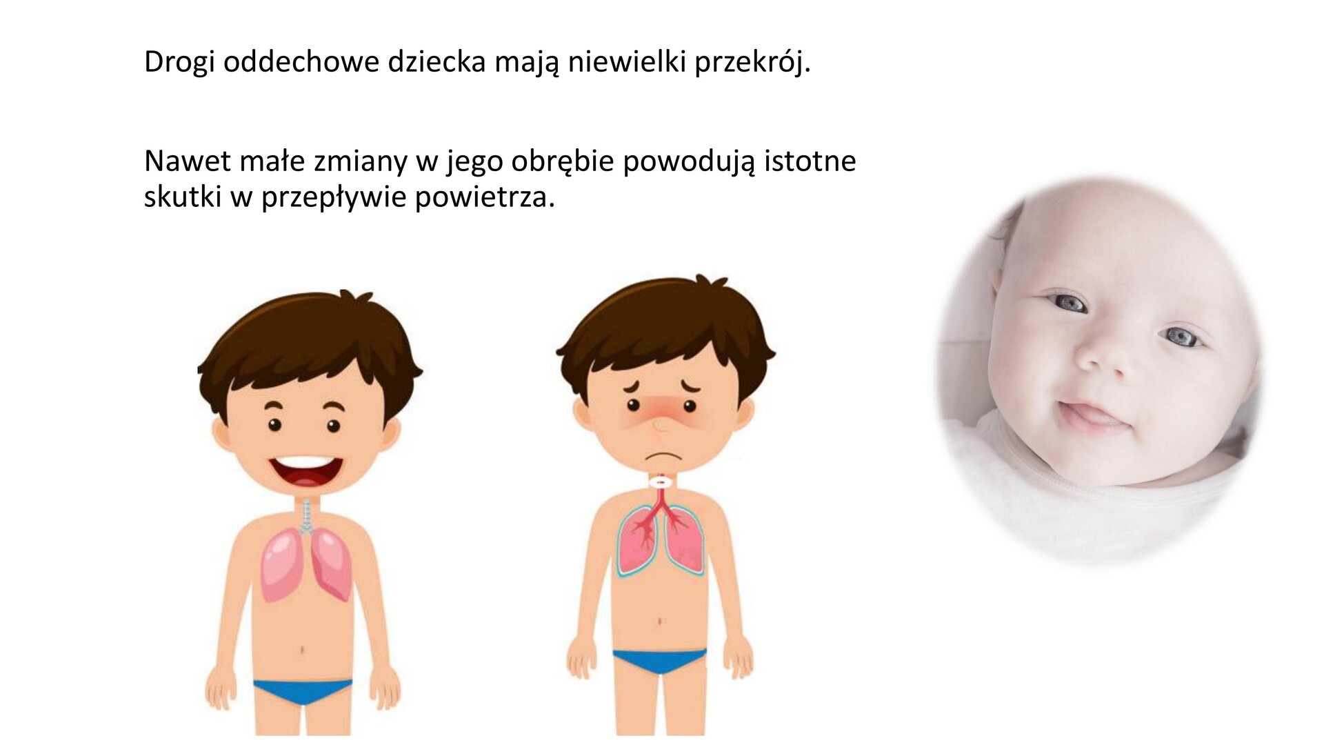 Biały slajd, który przedstawia dwie ilustracje, jedno zdjęcie oraz tekst. U dołu slajdu dwie ilustracje przedstawiające małego chłopca w niebieskich kąpielówkach. Obydwoje mają zaznaczone płuca. Chłopiec z lewej strony uśmiecha się, a chłopiec z prawej smuci, gdyż w jego gardle został zaznaczony połknięty przedmiot. Z prawej strony slajdu zdjęcie małego dziecka, wpatrującego się w obiektyw. W górnej części slajdu tekst: „Drogi oddechowe dziecka mają niewielki przekrój. Nawet małe zmiany w jego obrębie powodują istotne skutki w przepływie powietrza”.