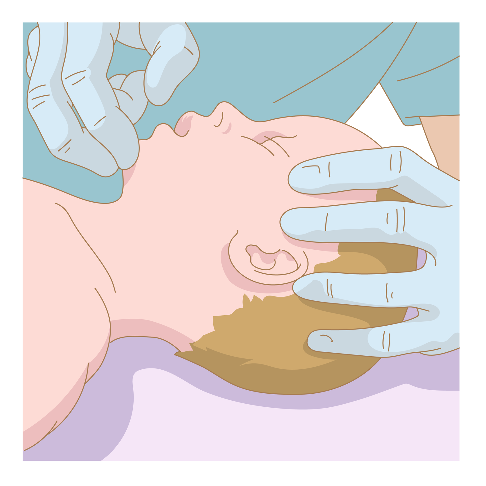 Kliknij żeby powiększyć Udrożnienie dróg oddechowych - ratownik jedną ręką trzyma dziecko za głowę i lekko ją odchyla, drugą trzymając na podbródku. Usta dziecka się rozchylają.