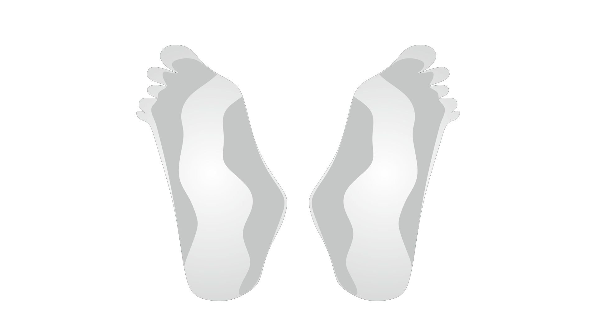 Grafika przedstawia schemat budowy stóp płasko koślawych, widzianych od strony podeszwy. Na schemacie zaznaczona jest budowa wystającej kości łódkowatej od strony wewnętrznej. 