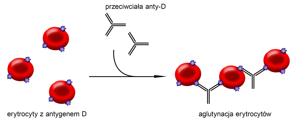 Grafika przedstawia mechanizm powstawania konfliktu serologicznego. Trzy czerwone erytrocyty o kształcie dwuwklęsłych dysków z antygenem D w formie wypustek o nieregularnym kształcie łączą się z dwoma przeciwciałami anty‑D. Przeciwciała maja postać zapisanych podwójna kreska liter Y. Proces ten prowadzi do aglutynacji erytrocytów – za pomocą dwóch przeciwciał anty‑D łączą się ze sobą w łańcuch trzy erytrocyty.