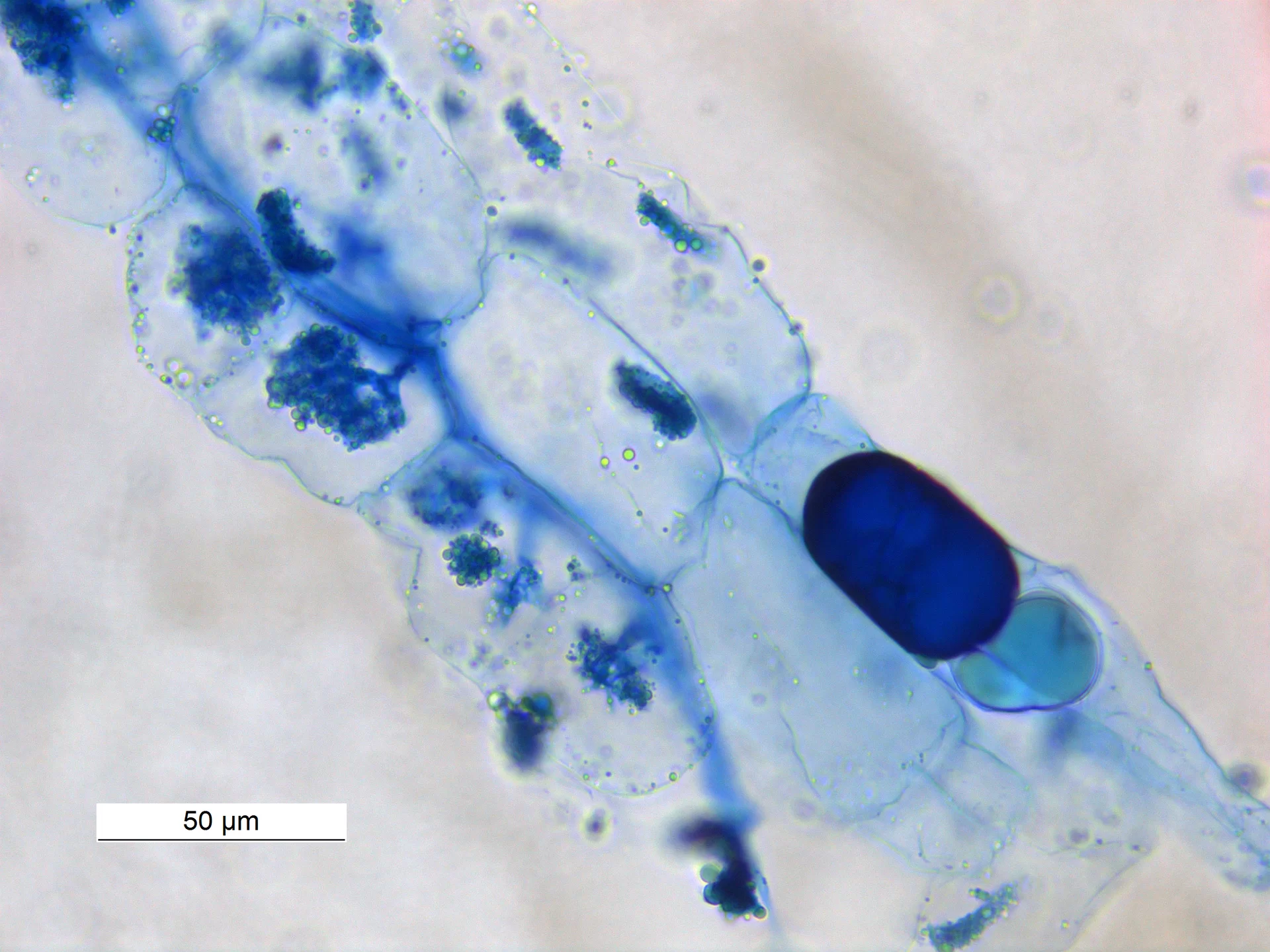 Arbuskule grzyba Rhizophagus nieregularnis widoczne we wnętrzu komórek korzenia rośliny strączkowej Macrotyloma uniflorum.