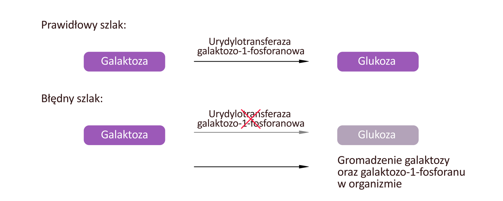 Ilustracja przedstawia dwa schematy. Pierwszy schemat ma podpis „Prawidłowy szlak”. Na schemacie mamy po lewej stronie hasło Galaktoza, od którego prowadzi w prawo strzałka z napisem Urydylotansferaza do hasła Glukoza. Drugi schemat ma podpis „Błędny szlak”. Na schemacie mamy po lewej stronie hasło Galaktoza, od którego prowadzi w prawo przekreślona strzałka z napisem Urydylotansferaza do hasła Glukoza. Pod spodem znajduje się druga strzałka i napis Gromadzenie galaktozy oraz galaktozo‑1-fosforanu w organizmie.