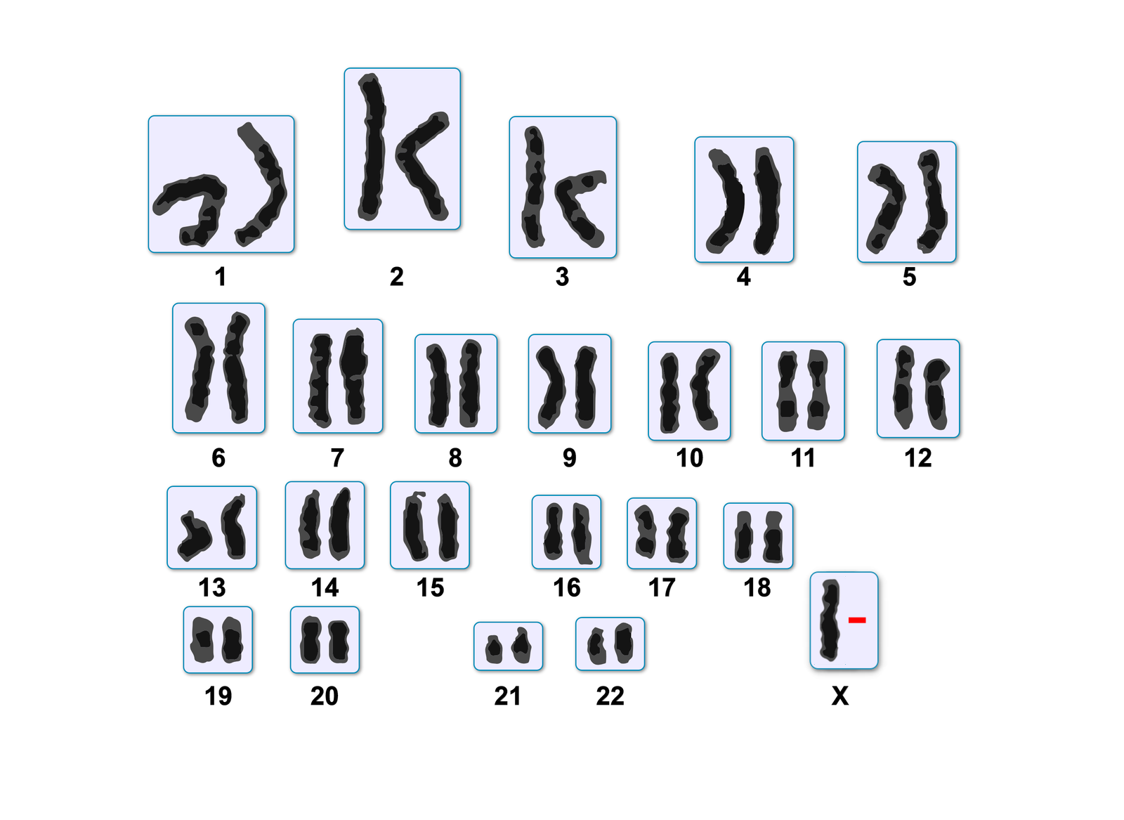  Ilustracja przedstawia kariotyp osoby z zespołem Turnera. Zawiera 22 pary chromosomów, a dodatkowo pojedynczy chromosom oznaczony dużą literą X. 