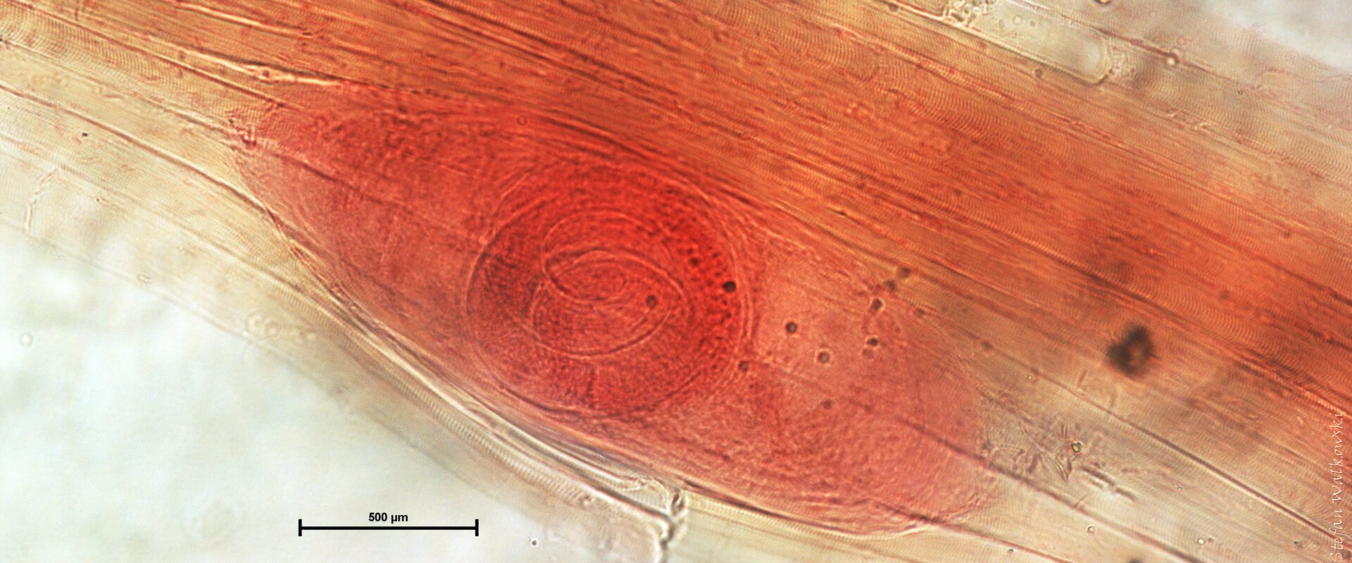 Fotografia mikroskopowa przedstawia podłużną cystę włośnia krętego w mięśniu świni. Cysta jest ułożona ukośnie, wzdłuż włókiem mięśnia. Jej wielkość można ocenić za pomocą podziałki na dole fotografii: 500 mikrometrów, czyli pół milimetra.