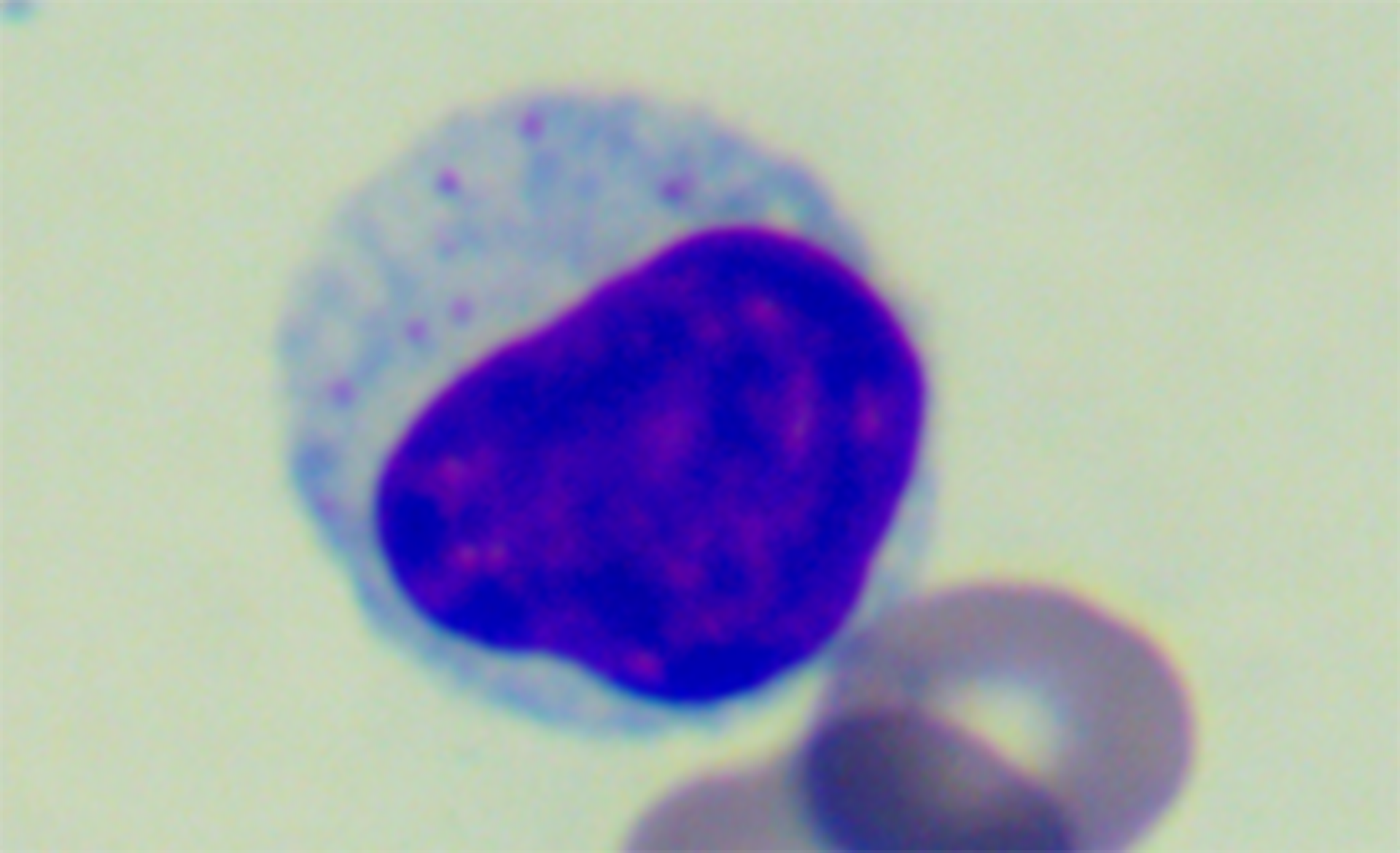 Na ilustracji jest obraz mikroskopowy w powiększeniu całkowitym: 1000 razy. Pokazano okrągłą strukturę. Częściowo zajmuje ją fioletowa plama z różowymi, drobnymi kropkami. Dookoła jest jasnoniebieski obszar z nielicznymi różowymi kropkami.