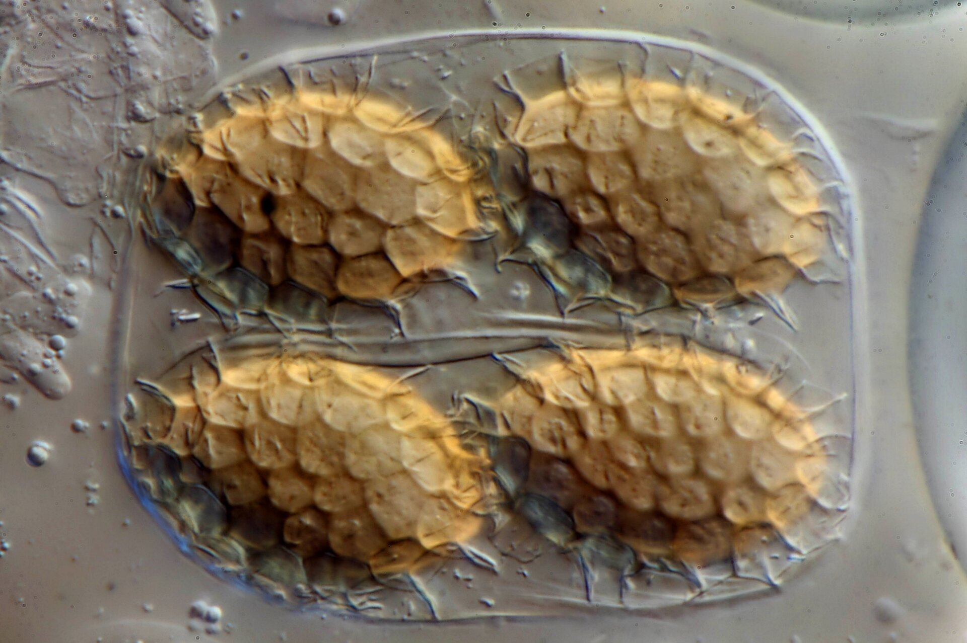 Zdjęcie przedstawia zarodniki workowate w przybliżeniu mikroskopu. Pod cienką, półprzeźroczystą błonką można wyróżnić cztery kuliste zarodniki. 