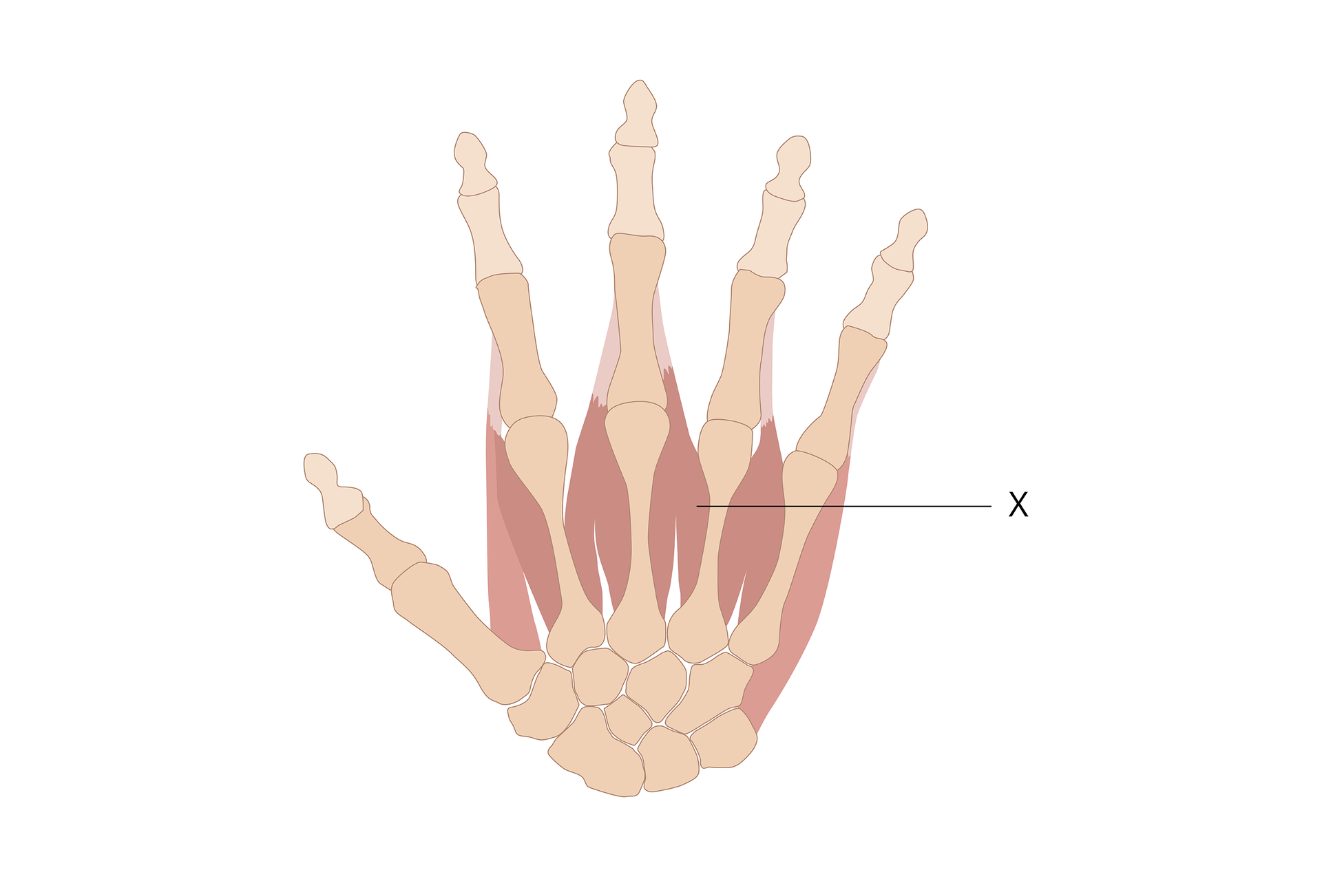 Na grafice widać dłoń człowieka. Widać kości oraz mięśnie śródręcza. Brzusiec mięśni są zaznaczone na czerwono, a ścięgna na biało. Literą X zaznaczona jest czerwona część mięśnia, która jest ułożona równolegle do kości śródręcza.