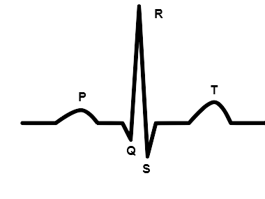 Ilustracja przedstawia fragment zapisu EKG 1. Od lewej strony jest niewielkie wybrzuszenie oznaczone jako P. Następnie jest niewielki spadek oznaczony literą Q, po czym gwałtowny wzrost do wartości maksymalnej. To R. Kolejno gwałtowny spadek nieco poniżej Q oznaczony jako S. Następnie jest wybrzuszenie nieco wyższe od P.