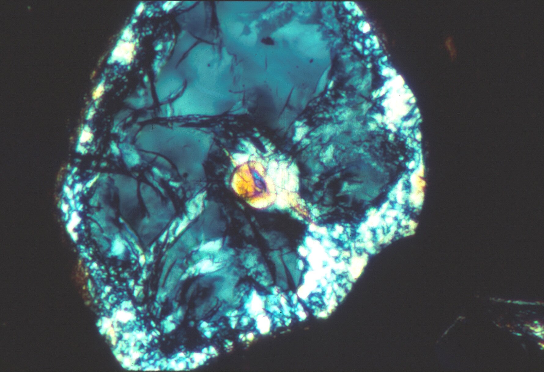 Na zdjęciu znajduje się twór o kształcie nieforemnego owalu. Jest koloru błękitnego. W centrum znajduje się mały owal koloru złotego. Wewnątrz błękitnej masy widocznych jest wiele czarnych, nitkowatych tworów.