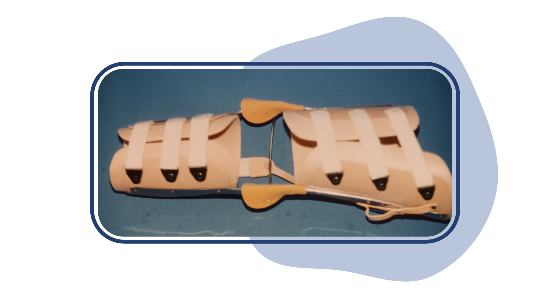 Zdjęcie przedstawia ortezę stabilizującą, którą okala się nogę pacjenta pod stawem kolanowym i nad stawem kolanowym. Orteza jest mocowana na rzepy. Oba elementy połączone są po dwóch stronach od boku metalową szyną. 