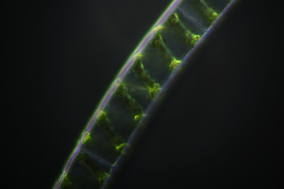 Zdjęcie spod mikroskopu świetlnego z zastosowaniem metody ciemnego pola w powiększeniu czterdziestokrotnym przedstawia zielenicę o nazwie skrętnica. Na zdjęciu znajduje się przezroczysty przewód podzielony na segmenty, a wzdłuż całego przekroju przewodu widoczna jest spiralnie ułożona, zielona struktura.  Przewód znajduje się na czarnym tle, zielona spirala jest lekko fosforyzująca. 