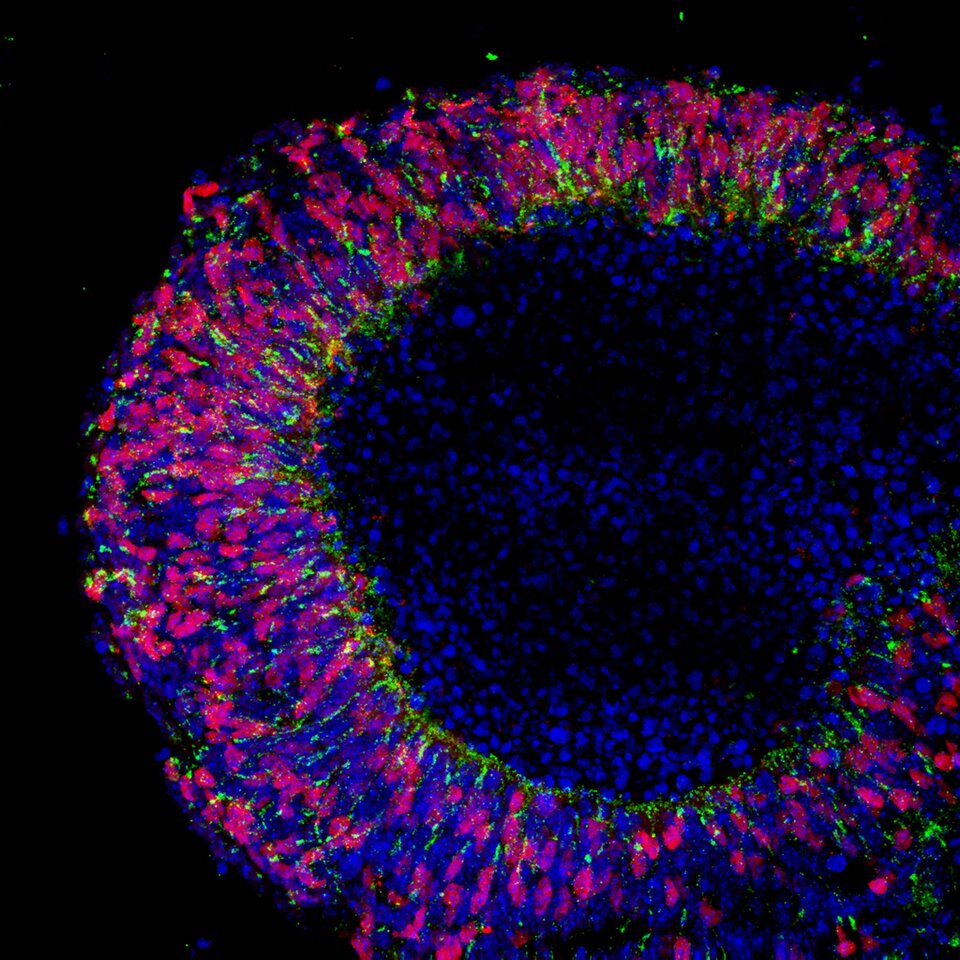 Zdjęcie spod mikroskopu fluorescencyjnego przedstawia owalny kształt z grubą otoczką, która składa się z czerwonych, niebieskich oraz zielonych plam. Środkowa część kształtu jest ciemna z rzadszymi niebieskimi plamami.
