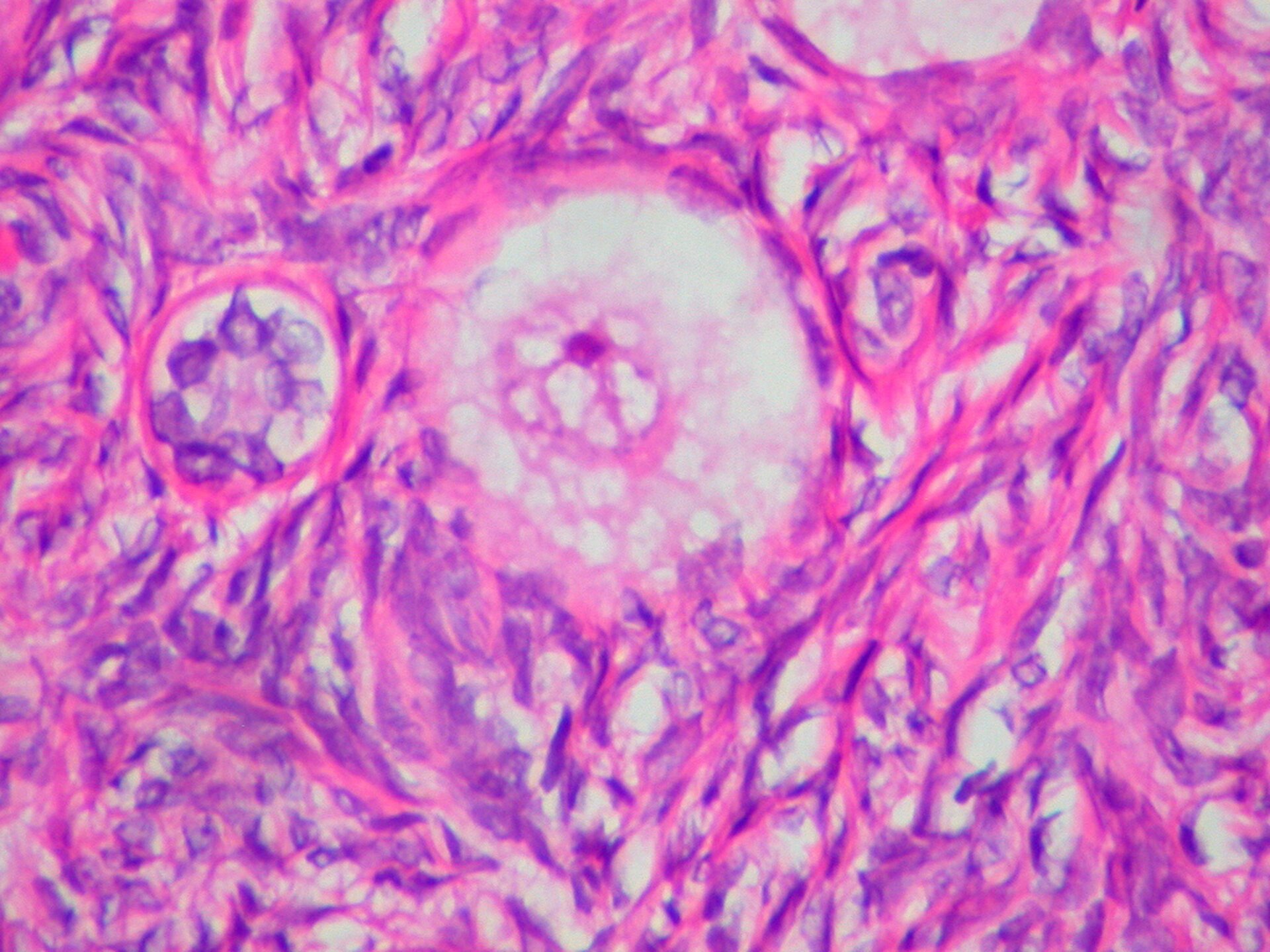 Na fotografii z mikroskopu przedstawiono bladoróżową, okrągłą ludzką komórkę jajową, otoczoną wybarwionymi na fioletowo i różowo komórkami. Wewnątrz komórki jajowej znajduje się wybarwione na różowo owalne jądro komórkowe.