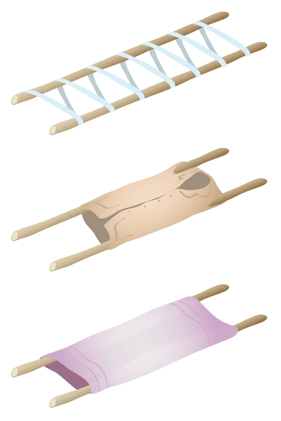 Ilustracja przedstawia trzy przykłady prowizorycznych noszy. Każde nosze zbudowane są na bazie dwóch długich kijów stanowiących stelaż. Połączenie drewnianych kijów jest różnorodne. W pierwszym przypadku kije połączone są szerokim pasem owiniętym wokół kijów, tworząc ukośną drabinkę. W drugim przypadku za element nośny służy duża męska koszula naciągnięta na kije przeciągnięte przez rękawy koszuli. W trzecim przypadku wokół kijów owinięty i naciągnięty jest gruby koc.