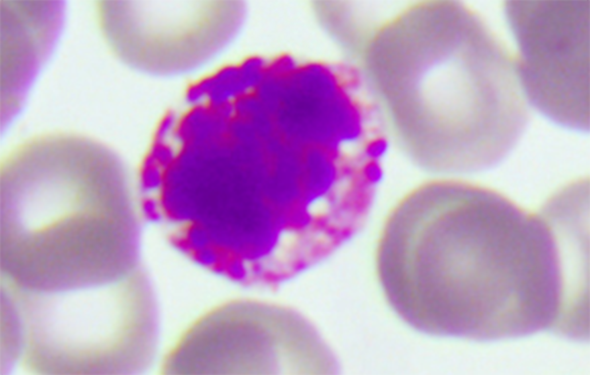 Na ilustracji jest obraz mikroskopowy w powiększeniu całkowitym: 1000 razy. Pokazano okrągłą strukturę o różowo‑fioletowym zabarwieniu. Dookoła są okrągłe jasnoróżowe struktury.