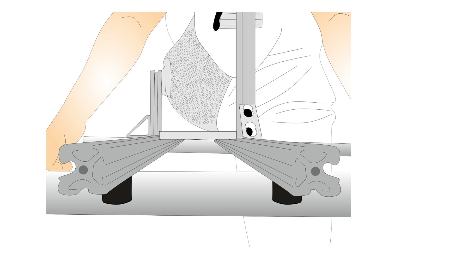 Rycina przedstawia metodę brania miary na kosz biodrowy typu bikini. Urządzenie pomiarowe jest umieszczone na dwóch podłużnych, metalowych szynach, zakończonych koszem pomiarowym z metalowej siatki, obejmującym kikut kończyny dolnej ze strony bocznej, oraz podłużnym elementem obejmującym kikut ze strony przyśrodkowej. 