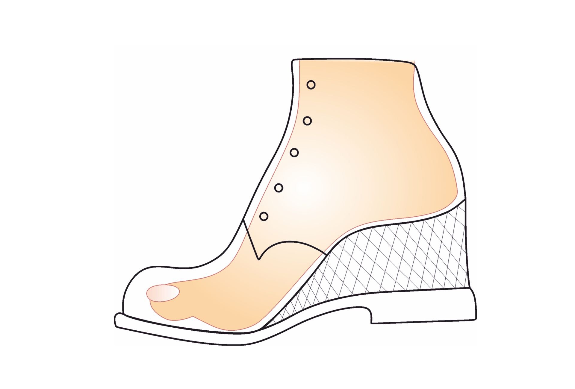 Grafika przedstawia schemat budowy buta oraz umiejscowienie w nim stopy. But zawiera wkładkę wyrównującą, która znajduje się wewnątrz obuwia, w formie koturnu, unoszącą śródstopie i piętę.