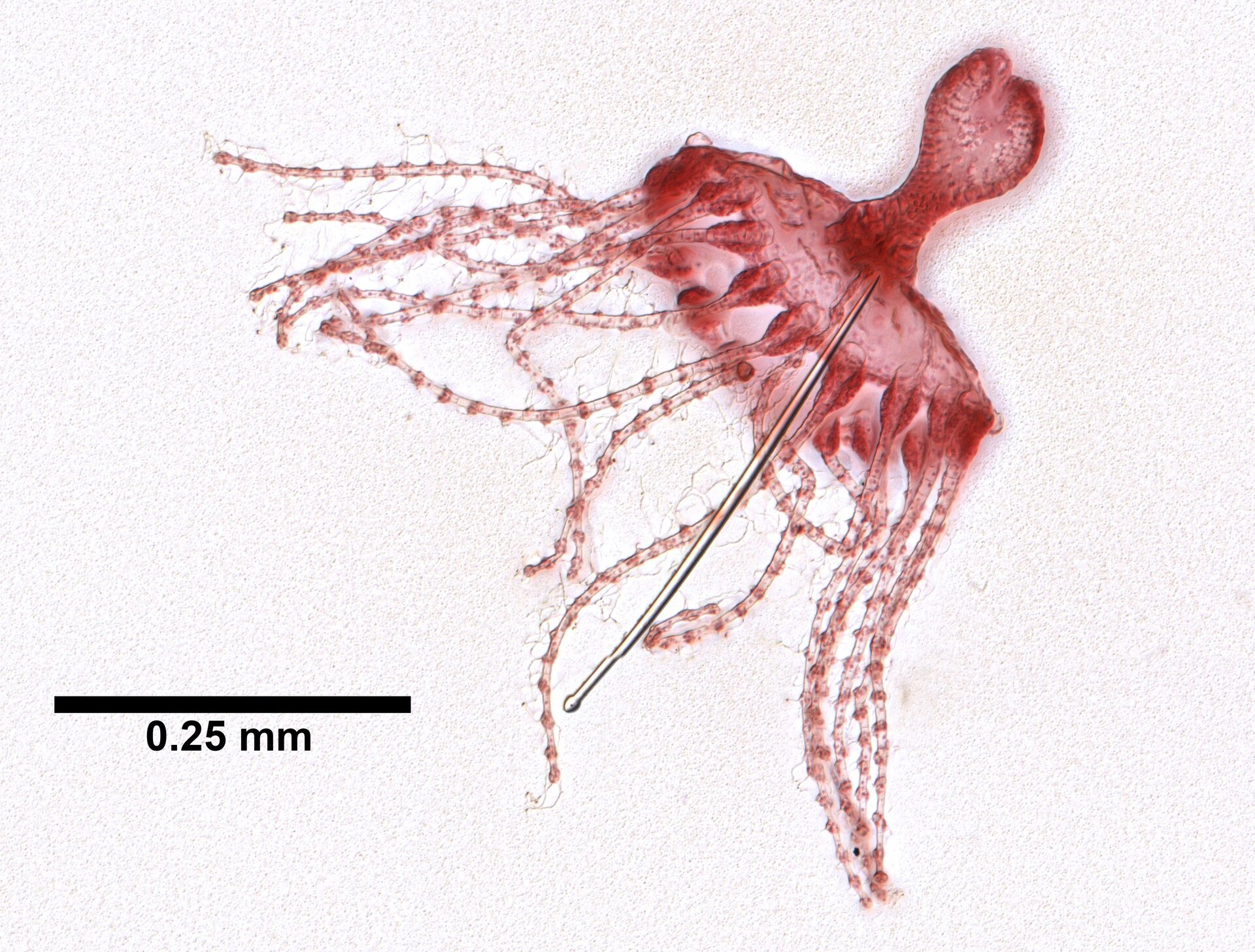 Zdjęcie A przedstawia jedną z form obelii. Zwierzę kształtem przypomina dzwon, ma liczne ramiona po spodniej części ciała. W dolnym lewym rogu widać linię, która symbolizuje dwadzieścia pięć setnych milimetra. Obelia ma około pięćdziesięciu setnych milimetra.