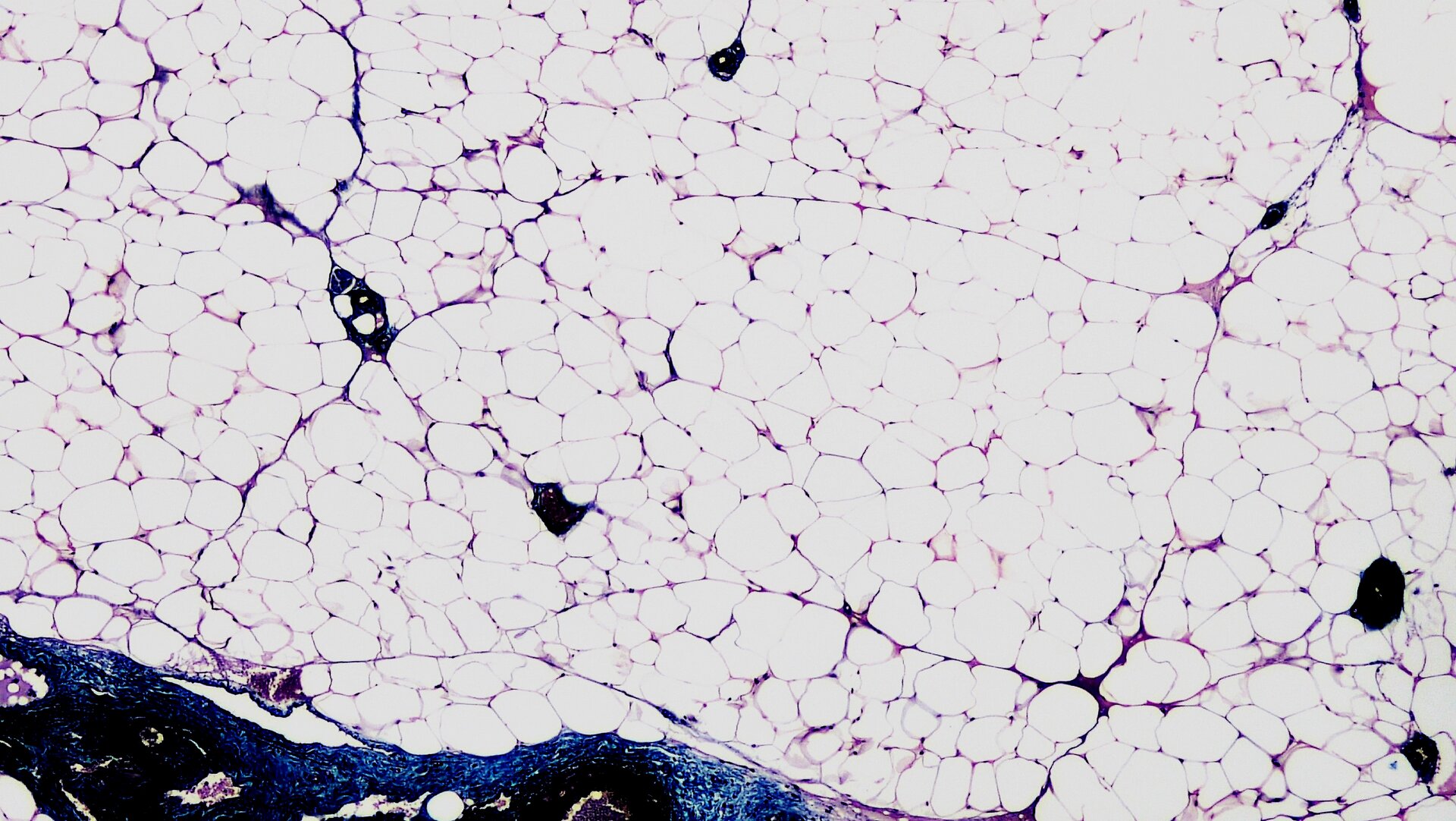 Zdjęcie przedstawia tkankę tłuszczową człowieka w powiększeniu mikroskopowym. Składa się ona z dużej ilości wielościennych, półprzezroczystych komórek tłuszczowych.  