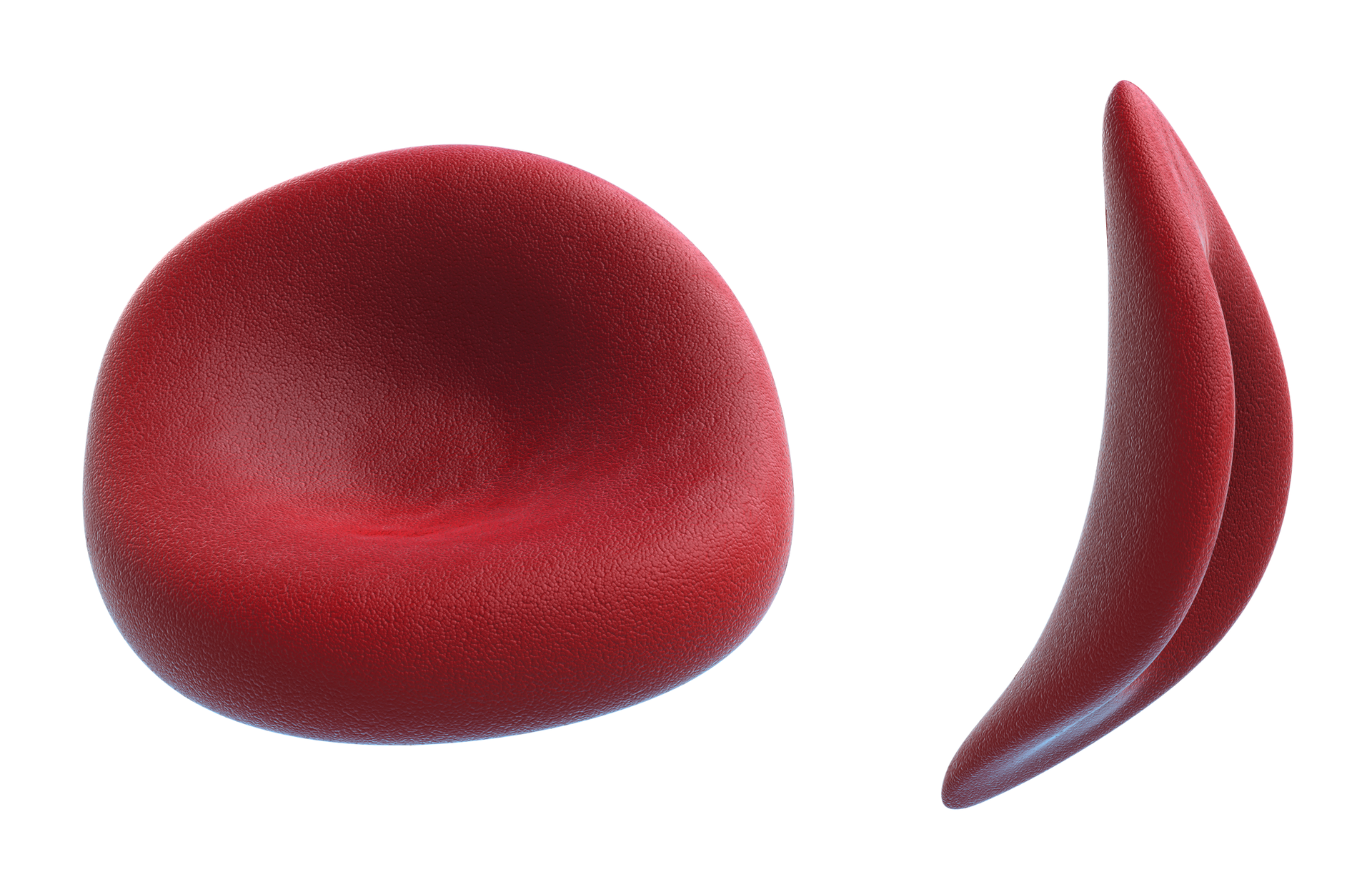 Ilustracja przedstawia dwa powiększone czerwone erytrocytyczłowieka. Z lewej prawidłowy, z prawej sierpowaty u człowieka chorego na anemię sierpowatą.