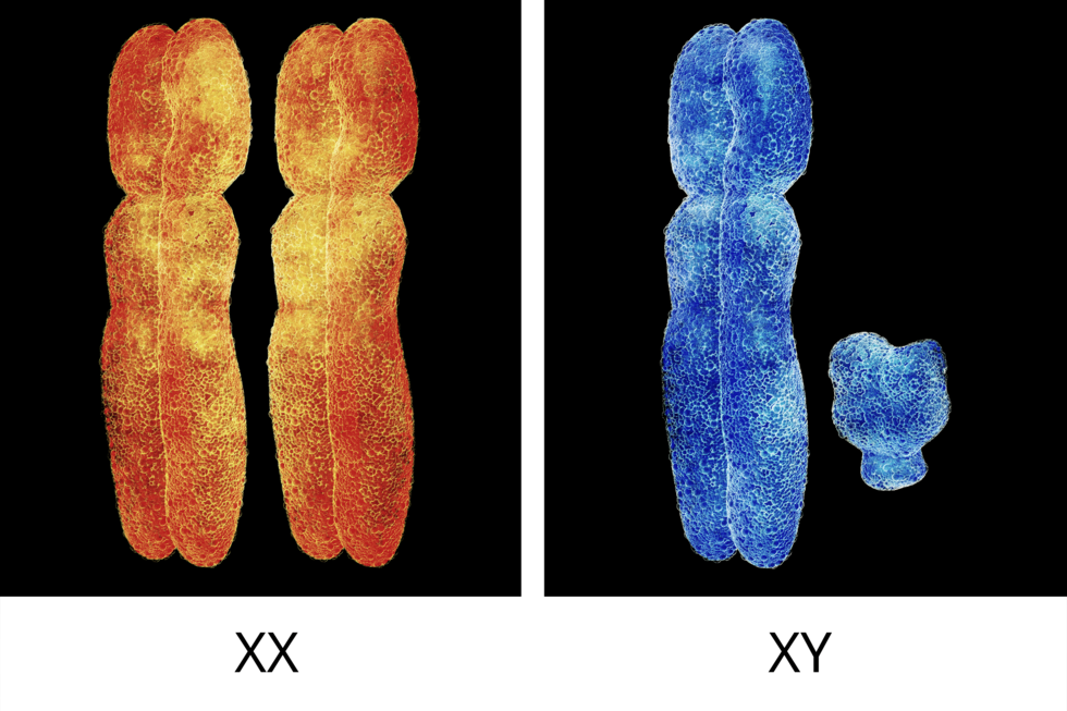 Ilustracja przestawia dwa zestawy chromosomów płci. Z lewej dwa grube, pomarańczowe chromosomy X (płeć żeńska). Z prawej jeden duży niebieski chromosom X, drugi mały niebieski chromosom Y.