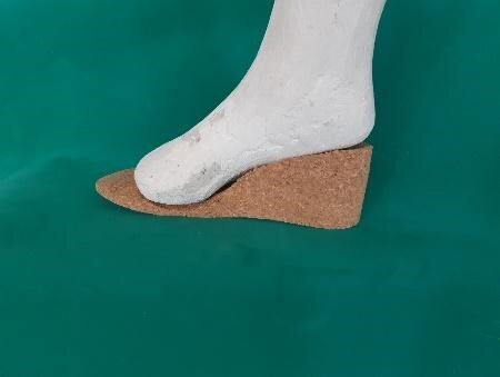Zdjęcie przedstawia odlew gipsowy stopy, od wewnętrznej strony, dopasowany do wkładki z płyty suberytowej.