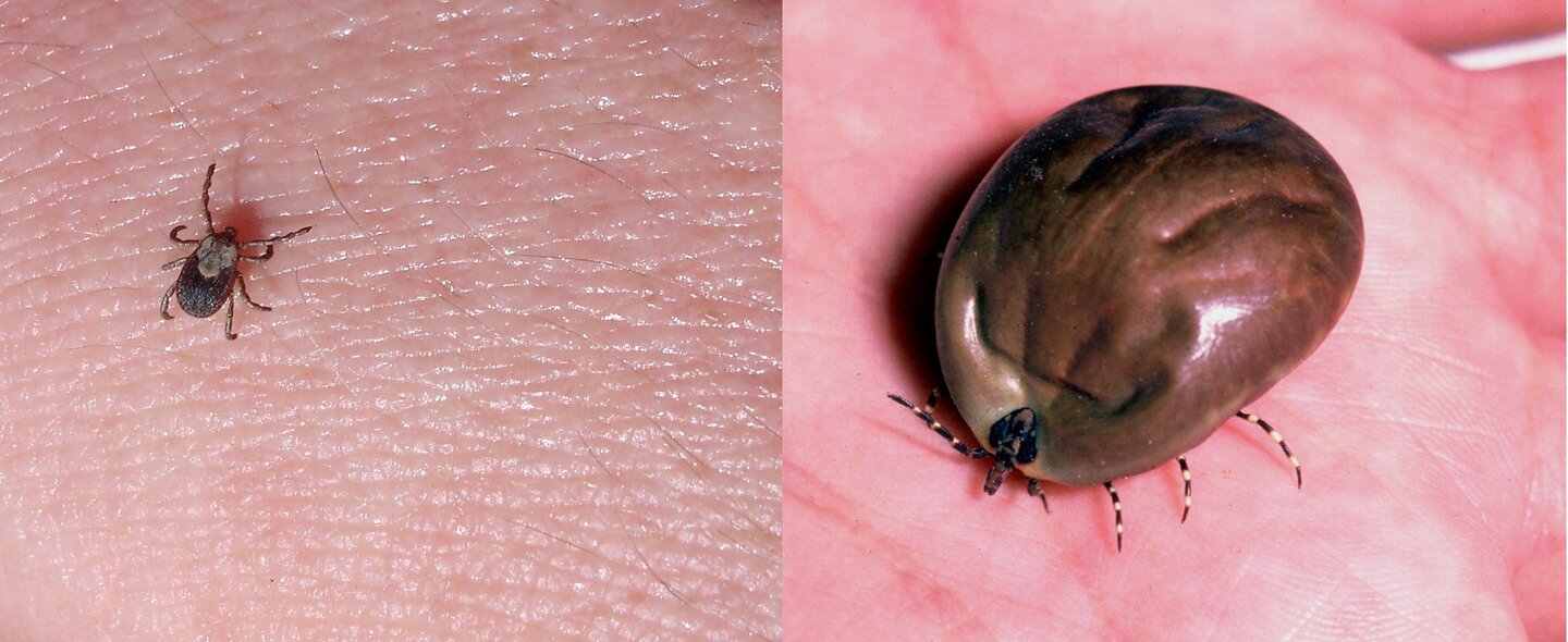 Dwa zdjęcia przedstawiające kleszcza. Pierwsze zdjęcie ilustruje kleszcza w powiększeniu. Na drugim zdjęciu widoczny jest kleszcz po wypiciu krwi. Ciao zwierzęcia jest znacznie większe. Można ocenić wielkość ciała porównując je z głową i kończynami.