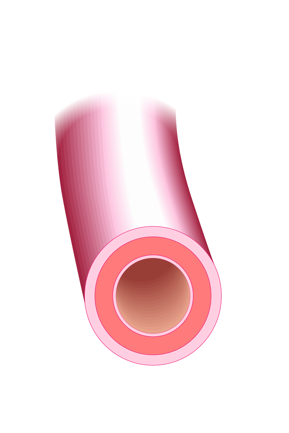 Grafika przedstawiająca fragment rurkowatego naczynia z widocznym przekrojem poprzecznym. Jest to tętnica zbudowana z trzech ścian różnej grubości oraz niewielkim otworze przeznaczonym do  przepływu krwi.