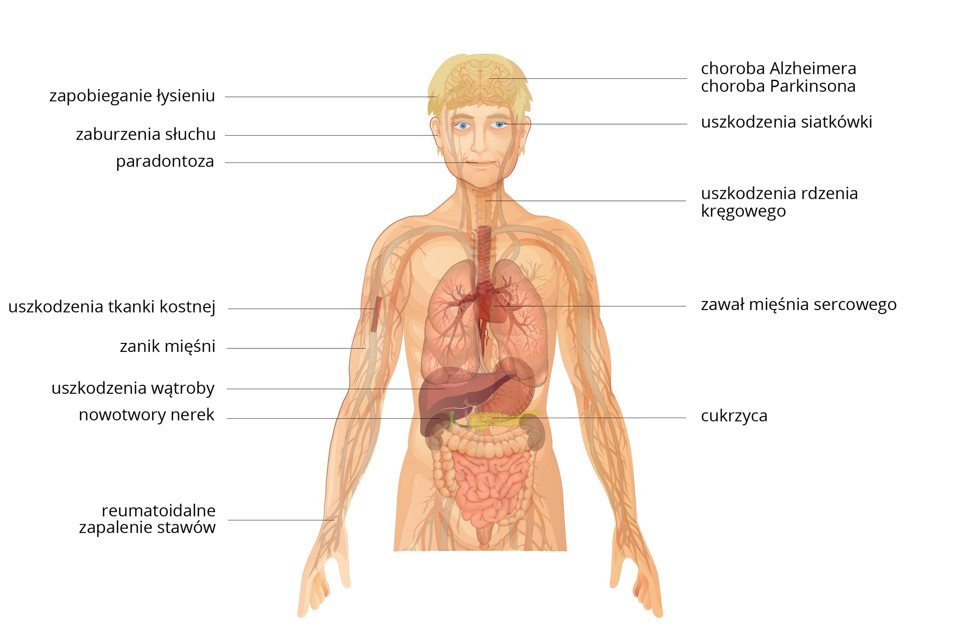 Ilustracja przedstawia sylwetkę człowieka z zaznaczonymi narządami układu oddechowego, pokarmowego oraz krwionośnego. Linie z opisami wskazują na poszczególne części ciała i jednostki chorobowe, które w przyszłości będzie można leczyć z wykorzystaniem terapii komórkowej. Linie wskazujące na mózg opisane są jako choroba Alzheimera i choroba Parkinsona, oczy - uszkodzenia siatkówki, odcinek szyjny kręgosłupa - uszkodzenia rdzenia kręgowego, serce - zawał mięśnia sercowego, trzustkę - cukrzyca, nadgarstki - reumatoidalne zapalenie stawów, nerki - nowotwory nerek, wątroba - uszkodzenia wątroby, ramię - zanik mięśni, kość ramienna - uszkodzenia tkanki kostnej, uszy - zaburzenia słuchu, zęby - parodontoza, włosy - zapobieganie łysieniu.