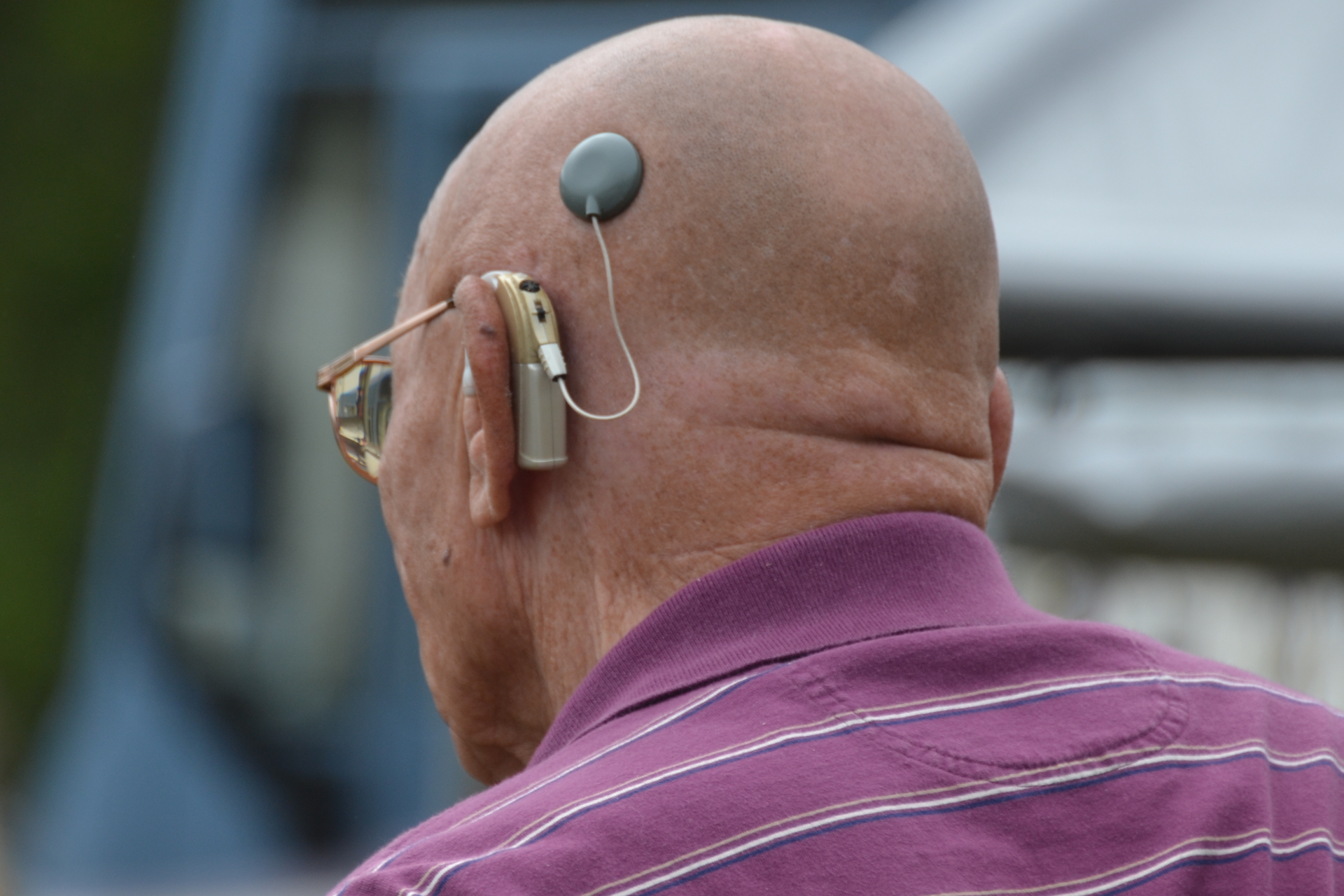 Fotografia przedstawia od tyłu głowę łysego mężczyzny. Za uchem ma zamocowany beżowy aparat słuchowy. Od niego przewód do wszczepionego, czarnego implantu słuchowego.