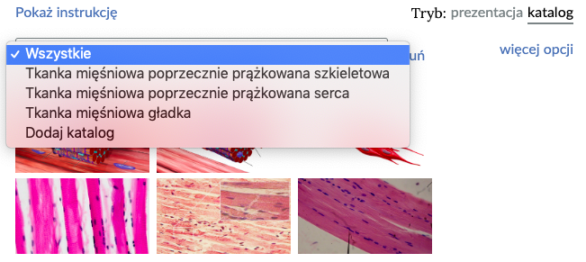 Zdjęcie przedstawia rozwinięty widok katalogu. Na górze znajduje się pasek wyszukiwarki. Wyświetlane są następujące opcje: wszystkie; tkanka mięśniowa poprzecznie prążkowana szkieletowa; tkanka mięśniowa poprzecznie prążkowana serca; tkanka mięśniowa głaska; dodaj katalog. Pod spodem widocznych jest sześć zdjęć przedstawiających tkanki.