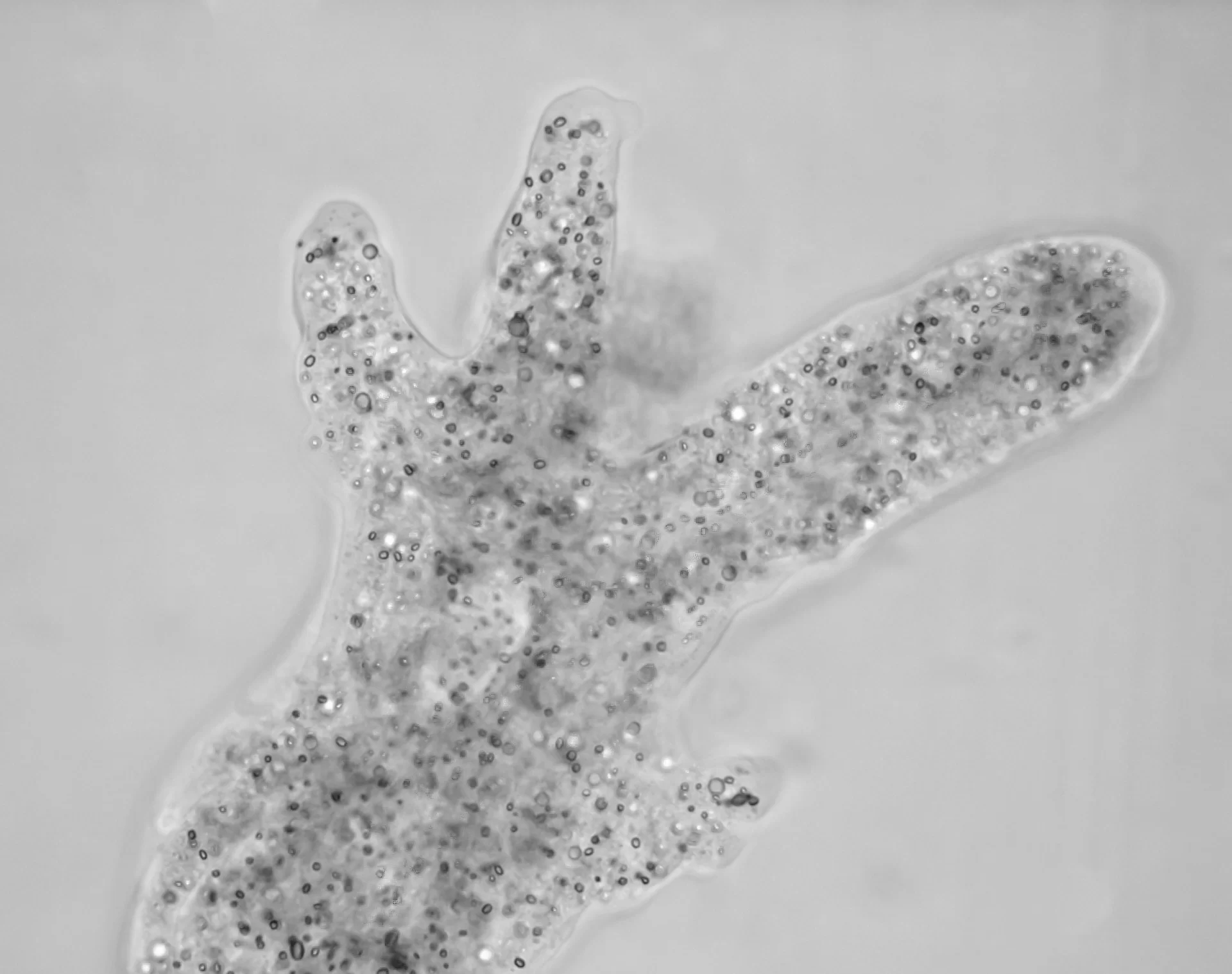 Zdjęcie mikroskopowe przedstawia amebę. Jest to protist o nieregularnym kształcie ciała.  